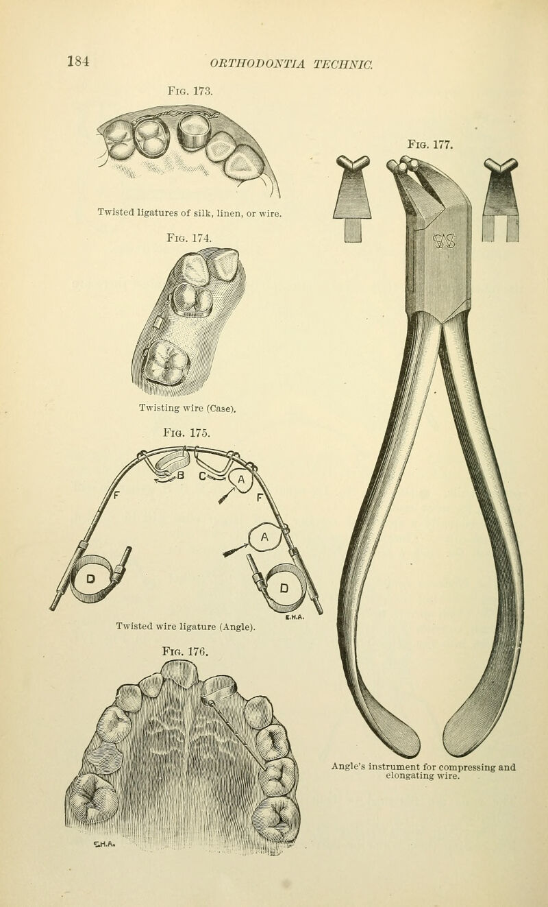 Fig. 173. Twisted ligatures of silk, linen, or wire. Fig. 174. in mill/ Twisting wire (Case), Fig. 175. Twisted wire ligature (Angle). Fig. 176. Fig. 177. Angle's instrument for compressing and elongating wire.