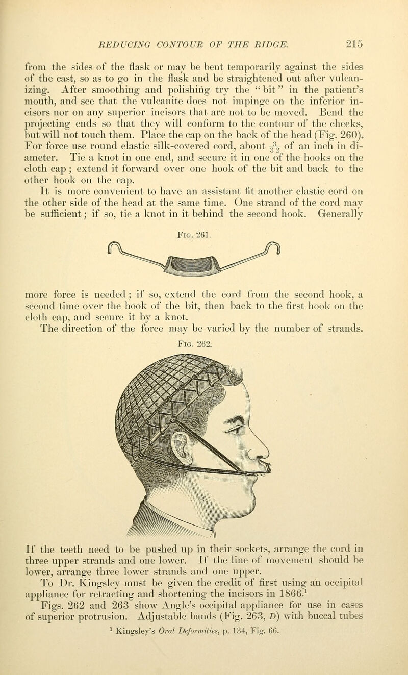 from the sides of the flask or may be bent temporarily against the sides of the cast, so as to go in the flask and be straightened out after vulcan- izing. After smoothing and polishing try the  bit in the patient's month, and see that the vulcanite does not impinge on the inferior in- cisors nor on any superior incisors that are not to be moved. Bend the projecting ends so that they will conform to the contour of the cheeks, but will not touch them. Place the cap on the back of the head (Fig. 260). For force use round elastic silk-covered cord, about -^ of an inch in di- ameter. Tie a knot in one end, and secure it in one of the hooks on the cloth cap; extend it forward over one hook of the bit and back to the other hook on the cap. It is more convenient to have an assistant fit another elastic cord on the other side of the head at the same time. One strand of the cord may be sufficient; if so, tie a knot in it behind the second hook. Generally Fig. 261. more force is needed; if so, extend the cord from the second hook, a second time over the hook of the bit, then back to the first hook on the cloth cap, and secure it by a knot. The direction of the force may be varied by the number of strands. Fig. 262. If the teeth need to be pushed up in their sockets, arrange the cord in three upper strands and one lower. If the line of movement should be lower, arrange three lower strands and one upper. To Dr. Kingsley must be given the credit of first using ah occipital appliance for retracting and shortening the incisors in 1866.^ Figs. 262 and 263 show Angle's occipital appliance for use in cases of superior protrusion. Adjustable bands (Fig. 263, D) with buccal tubes ^ Kingsley's Oral Deformities, p. 134, Fig. 66.