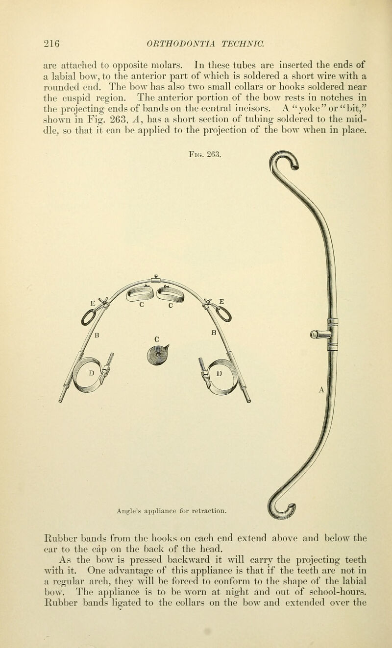 are attached to opposite molars. In these tubes are inserted the ends of a labial bow, to the anterior part of which is soldered a short wire with a rounded end. The bow has also two small collars or hooks soldered near the cuspid region. The anterior portion of the bow rests in notches in the projecting ends of bands on the central incisors. A yoke or bit, shown in Fig. 263, A, has a short section of tubing soldered to the mid- dlcj so that it can be applied to the projection of the bow when in place. Fig. 263. Angle's appliance for retraction. Rubber bands from the hooks on each end extend above and below the ear to the cap on the back of the head. As the bow is pressed backward it will carry the projecting teeth with it. One advantage of this appliance is that if the teeth are not in a regular arch, they will be forced to conform to the shape of the labial bow. The appliance is to be worn at night and out of school-hours. Rubber bauds ligated to the collars on the bow and extended over the