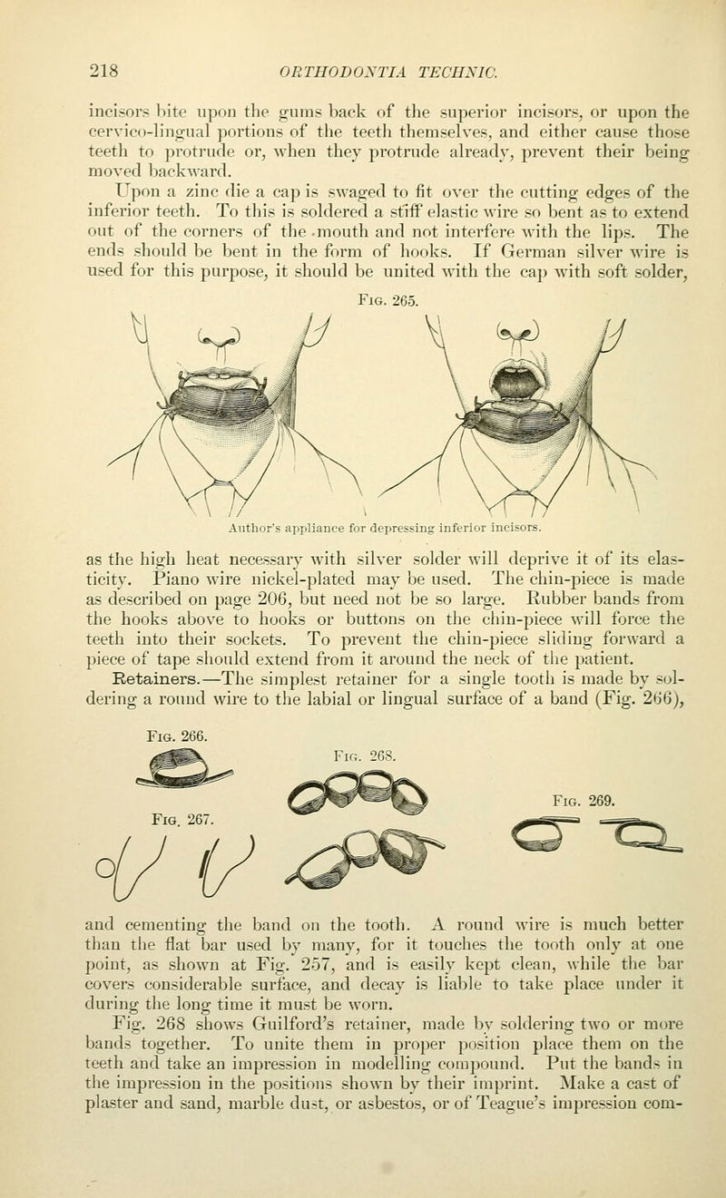 incisors bite upon the ^ums back of the cervico-lingiial portions of the teeth them teeth to protrude or, when they protrude moved backward. Upon a zinc die a cap is swaged to fit inferior teeth. To this is soklered a stiff el out of the corners of the .mouth and not ends should be bent in the form of hook used for this purpose, it shoukl be united Fig. 265. superior incisors, or upon the selves, and either cause those already, prevent their being over the cutting edges of the astic wire so bent as to extend interfere with the lips. The s. If German silver wire is with the cap with soft solder, Author's appliance for depressing inferior incisors. as the high heat necessary with silver solder will deprive it of its elas- ticity. Piano wire nickel-plated may be used. The chin-piece is made as described on page 206, but need not be so large. Rubber bands from the hooks above to hooks or buttons on the chin-piece will force the teeth into their sockets. To prevent the chin-piece sliding forward a piece of tape should extend from it around the neck of the patient. Retainers.—The simplest retainer for a single tooth is made by sol- dering a round wire to the labial or lingual surface of a band (Fig. 266), Fig. 266. Fio. 268. Fig. 269. and cementing the band on the tooth. A round wire is much better than the flat bar used by many, for it touches the tooth only at one point, as shown at Fig. 257, and is easily kept clean, while the bar covers considerable surface, and decay is liable to take place under it during the long time it must be worn. Fig. 268 shows Guilford's retainer, made by soldering two or more bands together. To unite them in proper position place them on the teeth and take an impression in modelling compound. Put the bands in the impression in the positions shown by their imprint. Make a cast of plaster and sand, marble dust, or asbestos, or of Teague's impression com-