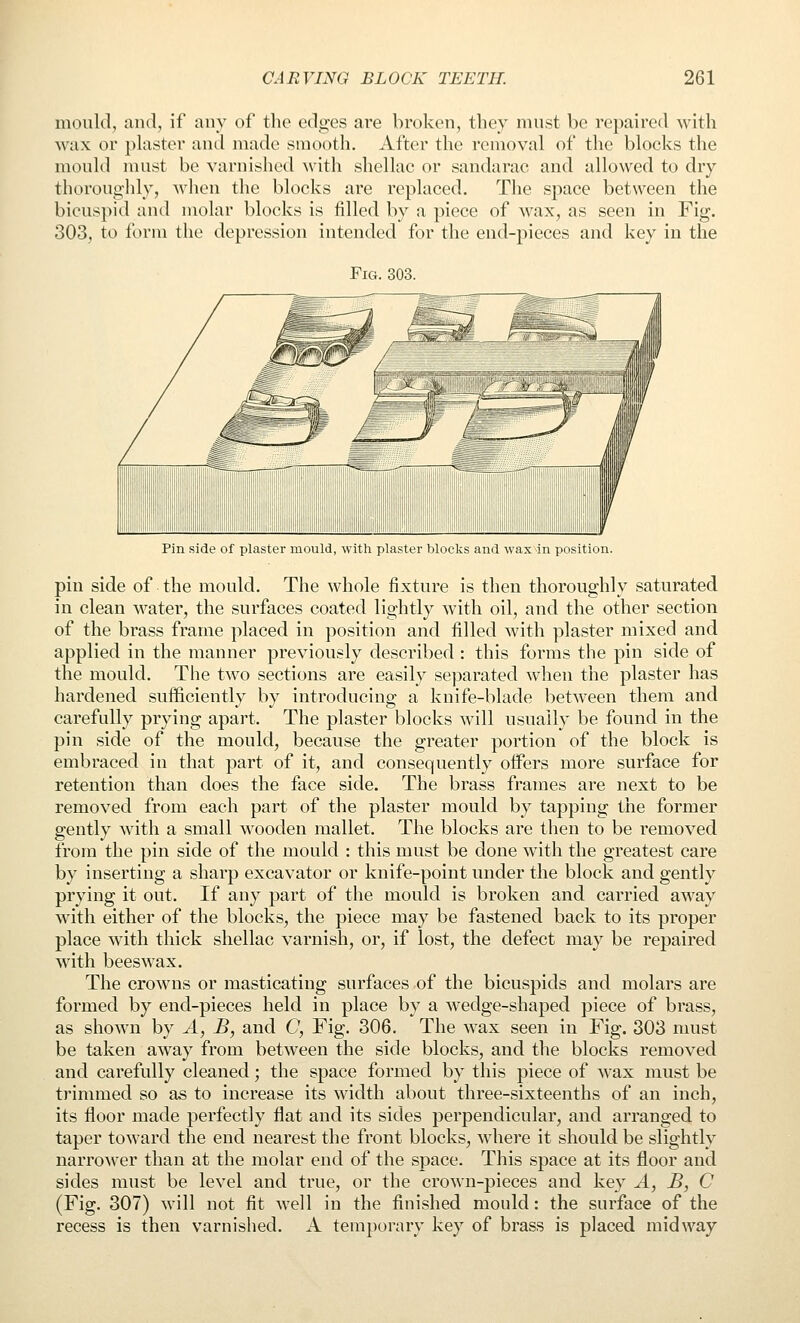 mould, and, if any of the edges are broken, they must be repaired with wax or ])laster and made smooth, Aft(;r the removal of tlie blocks the mould must be varnished with shellac or sandarac and allowed to dry thoroug-lily, wlien the blocks are replaced. The space between the bicuspid and molar blocks is filled by a piece of wax, as seen in Fig. 303, to form the depression intended for the end-pieces and key in the Fig. 303. Pin side of plaster mould, with plaster blocks and wax4n position. pin side of the mould. The whole fixture is then thoroughly saturated in clean water, the surfaces coated lightly with oil, and the other section of the brass frame placed in position and filled with plaster mixed and applied in the manner previously described : this forms the pin side of the mould. The two sections are easily separated when the plaster has hardened sufficiently by introducing a knife-blade between them and carefully prying apart. The plaster blocks will usually be found in the pin side of the mould, because the greater portion of the block is embraced in that part of it, and consequently offers more surface for retention than does the face side. The brass frames are next to be removed from each part of the plaster mould by tapping the former gently with a small wooden mallet. The blocks are then to be removed from the pin side of the mould : this must be done with the greatest care by inserting a sharp excavator or knife-point under the block and gently prying it out. If any part of the mould is broken and carried away with either of the blocks, the piece may be fastened back to its proper place with thick shellac varnish, or, if lost, the defect may be repaired with beeswax. The crowns or masticating surfaces of the bicuspids and molars are formed by end-pieces held in place by a wedge-shaped piece of brass, as shown by A, B, and C, Fig. 306. The wax seen in Fig. 303 must be taken away from between the side blocks, and the blocks removed and carefully cleaned; the space formed by this piece of wax must be trimmed so as to increase its width about three-sixteenths of an inch, its floor made perfectly flat and its sides perpendicular, and arranged to taper toward the end nearest the front blocks, where it should be slightly narrower than at the molar end of the space. This space at its floor and sides must be level and true, or the crown-pieces and key A, B, C (Fig. 307) will not fit well in the finished mould: the surface of the recess is then varnished. A temporary key of brass is placed midway