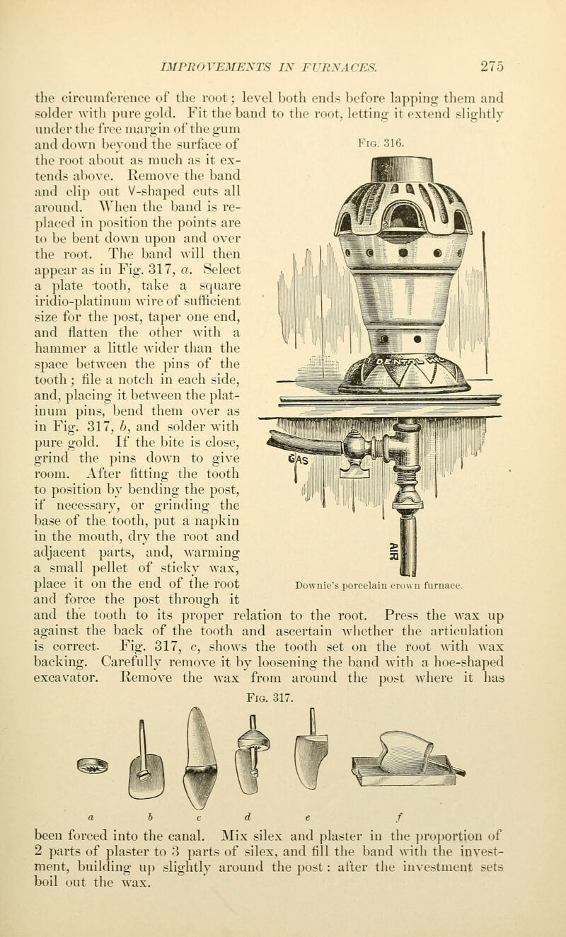 Fig. 316. the circumference of the root; level both ends before lapping them and solder with ]>ure gold. Fit the band to the root, letting it extend slightly under the free margin of tlie gum and down beyond the surface of the root about as much as it ex- tends above. Remove the band and clip out V-shaped cuts all around. When the band is re- placed in position the points are to be bent down upon and over the root. The band will then appear as in Fig. 317, a. Select a plate -tooth, take a square iridio-platinnm wire of sufficient size for the post, taper one end, and flatten the other with a hammer a little wider than the space between the pins of the tooth ; file a notch in each side, and, placing it between the plat- inum pins, bend them over as in Fig. 317, b, and solder with pure gold. If the bite is close, grind the pins down to give room. After fitting the tooth to position by bending the post, if uecessarv, or o-rinding: the base of the tooth, put a napkin in the mouth, dry the root and adjacent parts, and, warming a small pellet of sticky wax, place it on the end of the root and force the post through it and the tooth to its proper relation to the root. Press the wax up against the back of the tooth and ascertain whether the articulation is correct. Fig. 317, c, shows the tooth set on the root with wax backing. Carefully remove it by loosening the band with a hoe-shaped excavator. Remove tlie wax from around the post where it has Fig. 317. Downies porcelain crown furnace. c d e f been forced into the canal. Mix silex and plaster in the proportion of 2 parts of plaster to 3 parts of silex, and fill the band with the invest- ment, building up slightly around the post ''' ' ' '   boil out the wax. after the investment sets