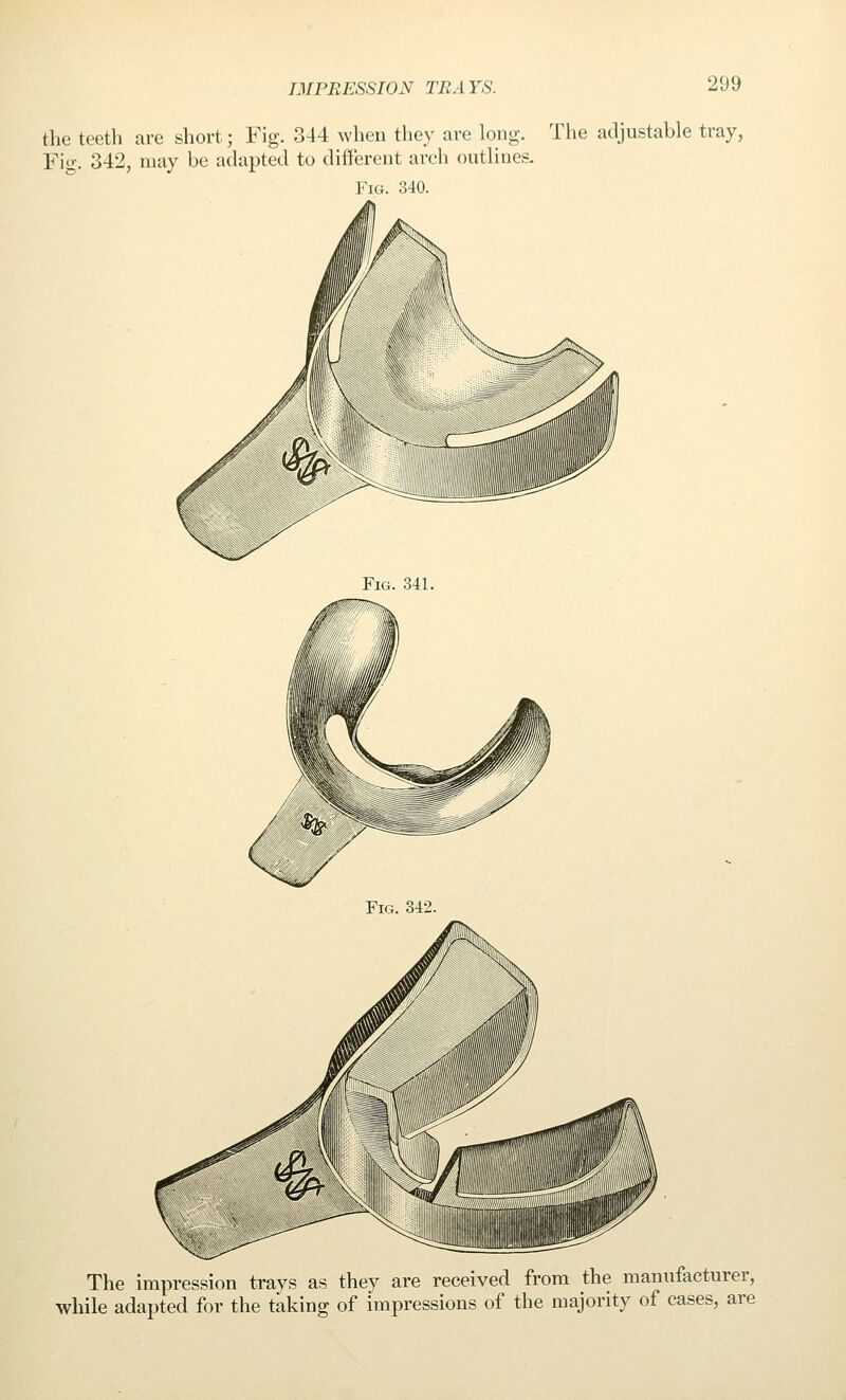 the teeth are short; Fig. 344 wheu they are long. The adjustable tray, Fio-. 342, may be adapted to different arch outlines. Fig. 340. The impression trays as they are received from the manufacturer, while adapted for the taking of impressions of the majority of cases, are