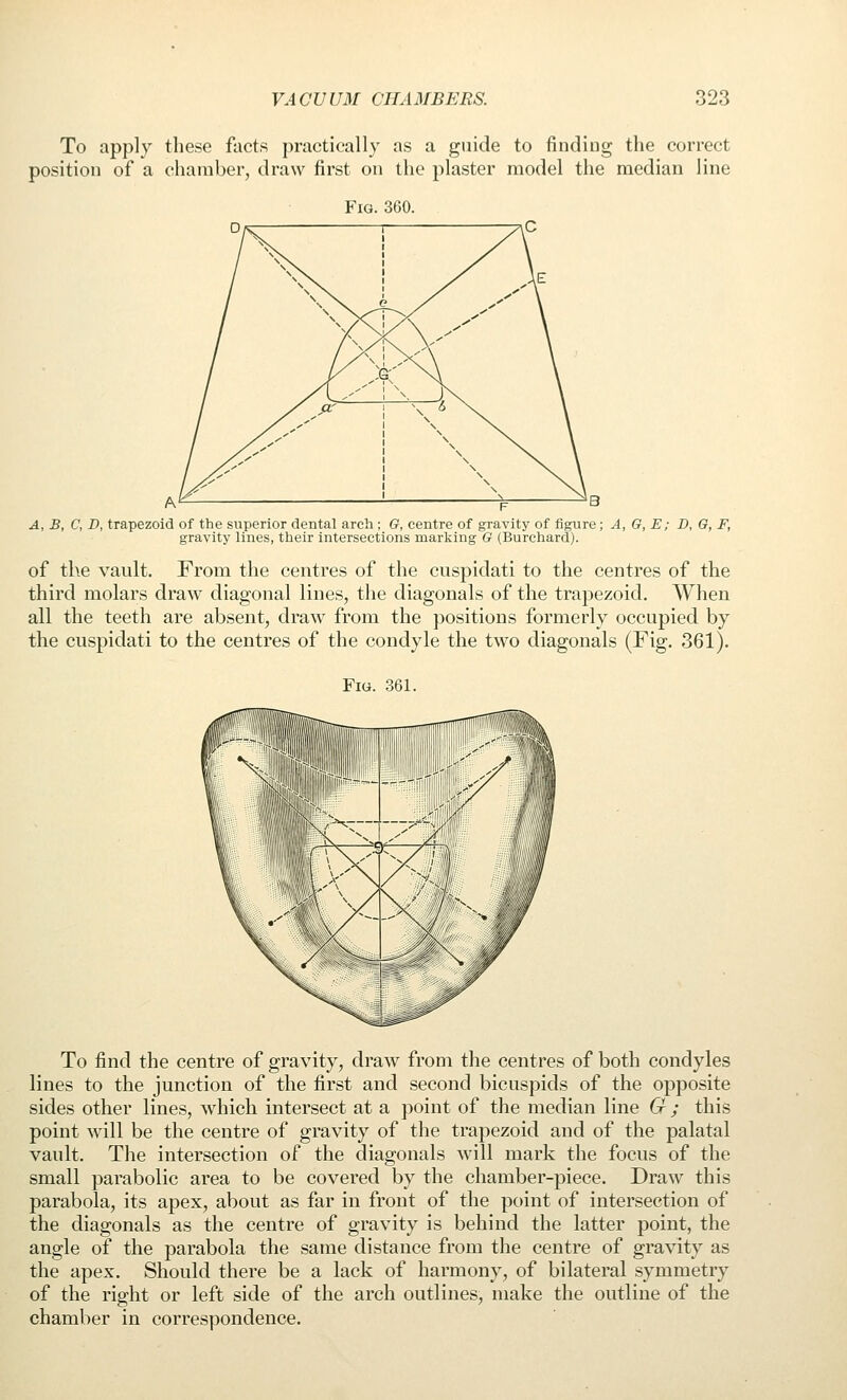 To apply these facts practically as a guide to finding the correct position of a chamber, draw first on the plaster model the median line Fig. 360. / / \ \ I > \ e > > / 0 \ ^ \ \ / \ \ / \ \ / \ \ / \ \ / y \ ^ / / \ / X.^ \ \^ \ / /,-' \ / y /^^ \ K \ \ \a A, B, C, D, trapezoid of the superior dental arch ; G, centre of gravity of figure; A, G, E; D, G, F, gravity lines, their intersections marking G (Burchard). of the vault. From the centres of the cuspidati to the centres of the third molars draw diagonal lines, the diagonals of the trapezoid. When all the teeth are absent, draw from the positions formerly occupied by the cuspidati to the centres of the condyle the two diagonals (Fig. 361). Fig. 361. To find the centre of gravity, draw from the centres of both condyles lines to the junction of the first and second bicuspids of the opposite sides other lines, which intersect at a point of the median line G ; this point will be the centre of gravity of the trapezoid and of the palatal vault. The intersection of the diagonals will mark the focus of the small parabolic area to be covered by the chamber-piece. Draw this parabola, its apex, about as far in front of the point of intersection of the diagonals as the centre of gravity is behind the latter point, the angle of the parabola the same distance from the centre of gravity as the apex. Should there be a lack of harmony, of bilateral symmetry of the right or left side of the arch outlines, make the outline of the chamber in correspondence.