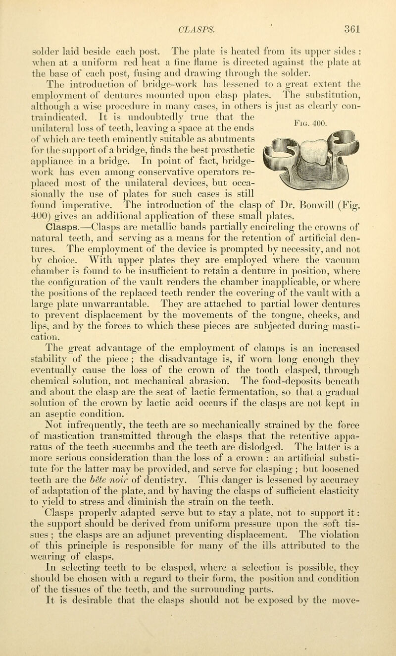 solder laid beside each post. The jilate is heated from its upper sides : when at a uniform red heat a iine Hanie is directed against the plate at the base of each post, fusing; and drawing through the solder. The introduction of bridge-work has lessened to a great extent the employment of dentures moinited upon clasp plates. The substitution, although a wise procedure in many cases, in others is just as clearly con- tra indicated. It is undoubtedly true that the unilateral loss of teeth, leaving a space at the ends of which are teeth emineutly suitable as abutments for the support of a bridge, finds the best prosthetic appliance in a bridge. In point of fact, bridge- work has even amoug conservative operators re- placed most of the unilateral devices, but occa- sionally the use of plates for such cases is still found imperative. The introduction of the clasp of Dr. Bonwill (Fig. 400) gives an additional application of these small plates. Clasps.—Clasps are metallic bands partially encircling the crowns of natural teeth, and serving as a means for the retention of artificial den- tures. The employment of the device is prompted by necessity, and not by choice. With upper plates they are employed where the vacuum chamber is found to be insufficient to retain a denture in position, where the configuration of the vault renders the chamber inapplicable, or where the positions of the replaced teeth render the covering of the vault with a large plate unwarrantable. They are attached to partial lower dentures to prevent displacement by the movements of the tongue, cheeks, and lips, and by the forces to which these pieces are subjected during masti- cation. The great advantage of the employment of clamps is an increased stability of the piece; the disadvantage is, if worn long enough they eventually cause the loss of the crown of the tooth clasped, through chemical solution, not mechanical abrasion. The food-deposits beneath and about the clasp are the seat of lactic fermentation, so that a gradual solution of the crown by lactic acid occurs if the clasps are not kept in an aseptic condition. Not infrequently, the teeth are so mechanically strained by the force of mastication transmitted through the clasps that the retentive appa- ratus of the teeth succumbs and the teeth are dislodged. The latter is a more serious consideration than the loss of a crown : an artificial substi- tute for the latter may be provided, and serve for clasping; but loosened teeth are the bite noir of dentistry. This danger is lessened by accuracy of adaptation of the plate, and by having the clasps of sufficient elasticity to yield to stress and diminish the strain on the teeth. Clasps properly adapted serve but to stay a plate, not to support it: the support should be derived from uniform pressure upon the soft tis- sues ; the clasps are an adjunct preventing displacement. The violation of this principle is responsible for many of the ills attributed to the wearing of clasps. In selecting teeth to be clasped, where a selection is possible, they should be chosen with a regard to their form, the position and condition of the tissues of the teeth, and the surrounding parts. It is desirable that the clasps should not be exposed by the move-