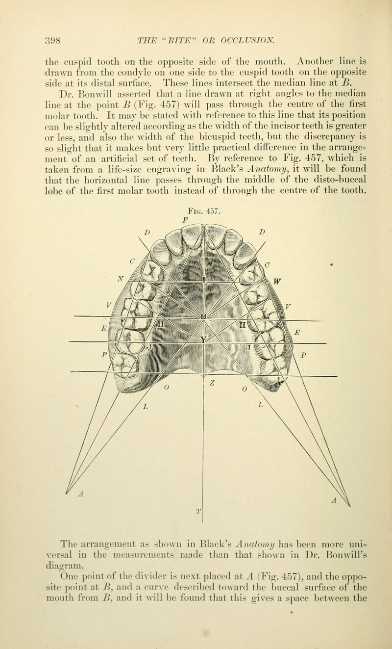 the cuspid tooth on the opposite side of the mouth. Another line is drawn from the condyle on one side to the cuspid tooth on the opposite side at its distal surface. These lines intersect the median line at B. Dr. Bonwill asserted that a line drawn at ric^ht angles to the median line at the point B (Fig. 457) will pass through the centre of the first molar tooth. It may be stated with reference to this line that its position can be slightly altered according as the width of the incisor teeth is greater or less, and also the width of the bicuspid teeth, but the discrepancy is so slight that it makes but very little practical diflPerence in the arrange- raentof an artificial set of teeth. By reference to Fig. 457, which is taken from a life-size engraving in Black's Anatomy, it will be found that the horizontal line passes through the middle of the disto-buccal lobe of the first molar tooth instead of through the centre of the tooth. Fig. 457. The arrangement as shown in Black's Anatomy has been more uni- versal in the measurements made than that shown in Dr. Bonwill's diagram. One point of the divider is next placed at A (Fig. 457), and the oppo- site point at B, and a curve described toward the buccal surface of the mouth from B, and it will be found that this gives a space between the