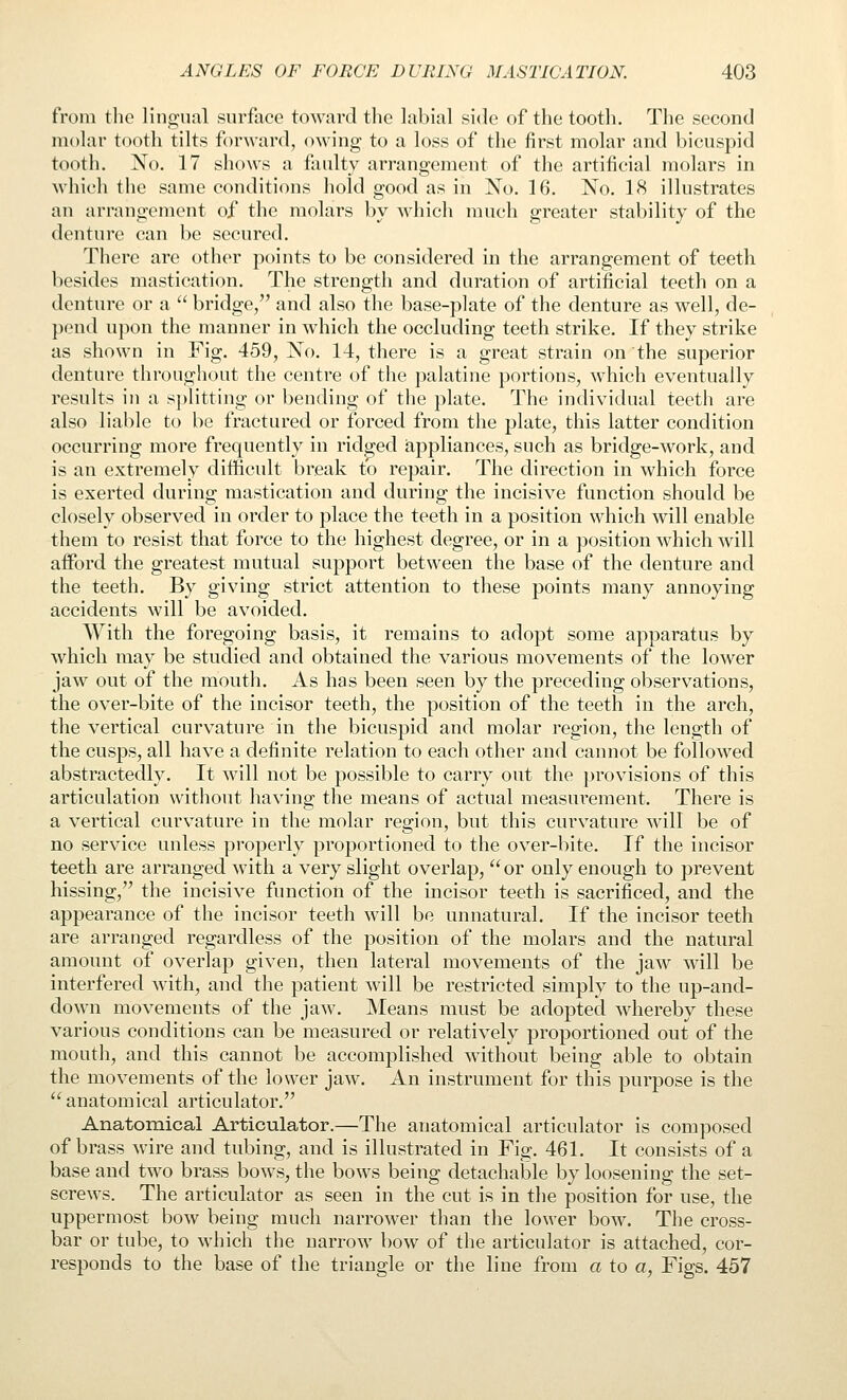 from the lingual surface towaixl tlie labial side of the tooth. The second molar tooth tilts forward, owing to a loss of the first molar and bicuspid tooth. No. 17 shows a faulty arrangement of the artificial molars in which the same conditions hold good as in No. 16. No. 18 illustrates an arrangement of the molars by which much greater stability of the denture can be secured. There are other points to be considered in the arrangement of teeth besides mastication. The strength and duration of artificial teeth on a denture or a  bridge/' and also the base-plate of the denture as well, de- pend upon the manner in which the occluding teeth strike. If they strike as shown in Fig. 459, No. 14, there is a great strain on the superior denture throughout the centre of the palatine portions, which eventually results in a splitting or bending of the plate. The individual teeth are also liable to be fractured or forced from the plate, this latter condition occurring more frequently in ridged appliances, such as bridge-work, and is an extremely difficult break to repair. The direction in which force is exerted during mastication and during the incisive function should be closely observed in order to place the teeth in a position which will enable them to resist that force to the highest degree, or in a position which will afford the greatest mutual support between the base of the denture and the teeth. By giving strict attention to these points many annoying accidents will be avoided. With the foregoing basis, it remains to adopt some apparatus by which may be studied and obtained the various movements of the lower jaw out of the mouth. As has been seen by the preceding observations, the over-bite of the incisor teeth, the position of the teeth in the arch, the vertical curvature in the bicuspid and molar region, the length of the cusps, all have a definite relation to each other and cannot be followed abstractedly. It will not be possible to carry out the provisions of this articulation without having the means of actual measurement. There is a vertical curvature in the molar region, but this curvature will be of no service unless properly proportioned to the over-bite. If the incisor teeth are arranged with a very slight overlap,  or only enough to prevent hissing, the incisive function of the incisor teeth is sacrificed, and the appearance of the incisor teeth will be unnatural. If the incisor teeth are arranged regardless of the position of the molars and the natural amount of overlap given, then lateral movements of the jaw will be interfered with, and the patient will be restricted simply to the up-and- down movements of the jaw. Means must be adopted whereby these various conditions can be measured or relatively proportioned out of the mouth, and this cannot be accomplished without being able to obtain the movements of the lower jaw. An instrument for this purpose is the  anatomical articulator. Anatomical Articulator.—The anatomical articulator is composed of brass wire and tubing, and is illustrated in Fig. 461. It consists of a base and two brass bows, the bows being detachalble by loosening the set- screws. The articulator as seen in the cut is in the position for use, the uppermost bow being much narrower than the lower bow. The cross- bar or tube, to which the narrow bow of the articulator is attached, cor- responds to the base of the triangle or the line from a to a, Figs. 457