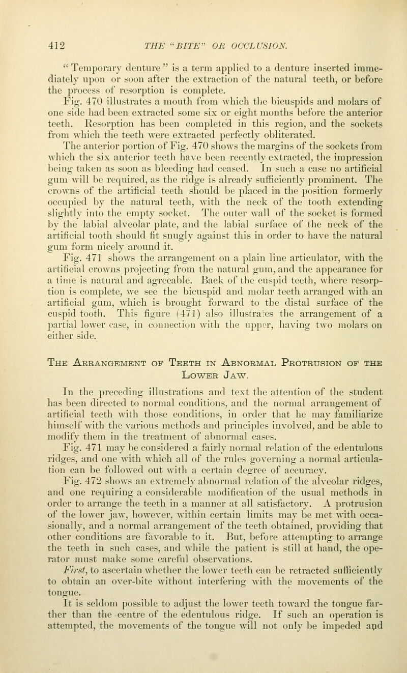  Temporary denture  is a term applied to a denture inserted imme- diately upon or soon after the extraction of tlie natural teeth, or before the process of resorjDtion is complete. Fig. 470 illustrates a moutli from which tlie bicuspids and molars of one side had been extracted some six or eight months before the anterior teeth. Resorption has been completed in this region, and the sockets from which the teeth were extracted perfectly obliterated. The anterior portion of Fig. 470 shows the margins of the sockets from which the six anterior teeth have been recently extracted, the impression being taken as soon as bleeding had ceased. In such a case no artificial gum will be required, as the ridge is already sufficiently prominent. The crowns of the artificial teeth should be placed in the position formerly occupied by the natural teeth, with the neck of the tooth extending slightly into the empty socket. The outer wall of the socket is formed by the labial alveolar plate, and tlie labial surface of the neck of the artificial tooth should fit snugly against this in order to have the natural gum form nicely around it. Fig. 471 shows the arrangement on a plain line articulator, with the artificial crowns projecting from the natural gum, and the appearance for a time is natural and agreeable. Back of tlie cuspid teeth, where resorp- tion is complete, we see the bicuspid and molar teeth arranged with an artificial gum, which is brought forward to the distal surface of the cuspid tootli. This figure (471) also illustrares the arrangement of a partial lower case, in connection with the upper, having two molars on either side. The Arrangement of Teeth in Abnormal Protrusion of the Lower Jaw. In the preceding illustrations and text the attention of the student has been directed to normal conditions, and the normal arrangement of artificial teeth with those conditions, in order that he may familiarize himself with the various methods and principles involved, and be able to modify them in the treatment of abnormal cases. Fig. 471 may be considered a fairly normal relation of the edentulous ridges, and one with which all of the rules governing a normal articula- tion can be followed out with a certain degree of accuracy. Fig. 472 shows an extremely abnormal relation of the alveolar ridges, and one requiring a considerable modification of the usual methods in order to arrange the teeth in a manner at all satisfactory. A protrusion of the lower jaw, however, within certain limits may be met with occa- sionally, and a normal arrangement of the teeth obtained, providing that other conditions are favorable to it. But, before attempting to arrange the teeth in such cases, and while the patient is still at hand, the ope- rator must make some careful observations. First, to ascertain whetlier the lower teeth can be retracted sufficiently to obtain an over-bite without interfering with the movements of the tongue. It is seldom possible to adjust the lower teeth tow'ard the tongue far- ther than the centre of the edentulous ridge. If such an operation is attempted, the movements of the tongue will not only be impeded apd