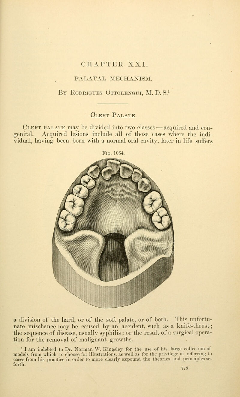 CHAPTER XXI. PALATAL MECHANISM. By Rodrigues Ottolengui, M. D. S.^ Cleft Palate. Cleft palate may be divided into two classes — acquired and con- genital. Acquired lesions include all of those cases where the indi- vidual, having been born with a normal oral cavity, later in life suffers Fig. 1064. a division of the hard, or of the soft palate, or of both. This unfortu- nate mischance may be caused by an accident, such as a knife-thru.st; the sequence of disease, usually syphilis; or the result of a surgical opera- tion for the removal of malignant growths. ^ I am indebted to Dr. Norman W. Kingsley for the use of his hirge collection of models from which to choose for illustrations, as well as for the privilege of referring to cases from his practice in order to more clearly expound the theories and principles set forth.