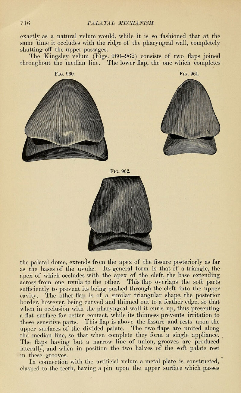 exactly as a natural velum would, while it is so fashioned that at the same time it occludes with the ridge of the pharyngeal wall, completely shutting off the upper passages. The Kingsley velum (Figs. 960-962) consists of two flaps joined throughout the median line. The lower flap, the one which completes Fig. 960. Fig. 961. Fig. 962. the palatal dome, extends from the apex of the fissure posteriorly as far as the bases of the uvulse. Its general form is that of a triangle, the apex of which occludes with the apex of the cleft, the base extending across from one uvula to the other. This flap overlaps the soft parts sufiiciently to prevent its being pushed through the cleft into the upper cavity. The other flap is of a similar triangular shape, the posterior border, however, being curved and thinned out to a feather edge, so that when in occlusion with the pharyngeal wall it curls up, thus presenting a flat surface for better contact, while its thinness prevents irritation to these sensitive parts. This flap is above the fissure and rests upon the upper surfaces of the divided palate. The two flaps are united along the median line, so that when complete they form a single appliance. The flaps having but a narrow line of union, grooves are produced laterally, and when in position the two halves of the soft palate rest in these grooves. In connection with the artificial velum a metal plate is constructed, clasped to the teeth, having a pin upon the upper surface which passes