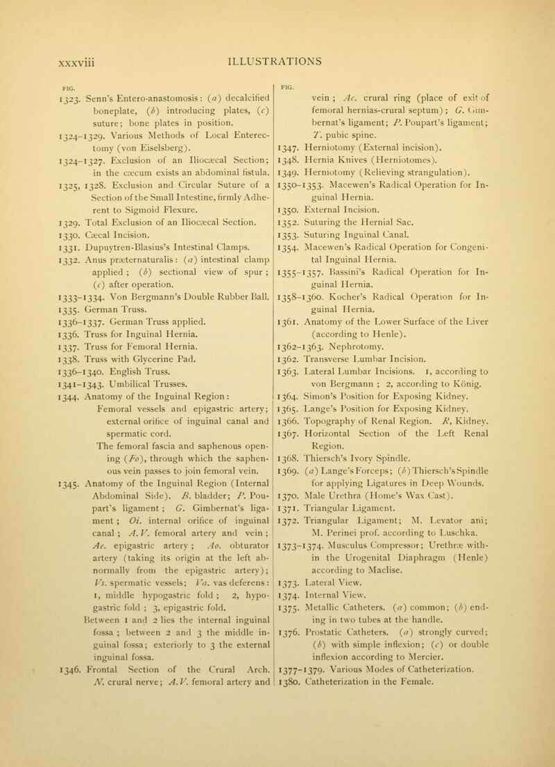 1323. Senn's Entero-anastomosis: (a) decalcified boneplate, {l>) introducing plates, (c) suture; bone plates in position. 1324-1329. Various Methods of Local Enterec- tomy (von Eiselsberg). 1347- 1324-1327. Exclusion of an Iliocffical Section; 1348. in the caecum exists an abdominal fistula. 1349. 1325, 1328. Exclusion and Circular Suture of a 1350- Section of the Small Intestine, firmly Adhe- rent to Sigmoid Flexure. I350- 1329. Total Exclusion of an Ilioccecal Section. 1352. 1330. Csecal Incision. 1353- 1331. Dupuytren-Blasius's Intestinal Clamps. I354- 1332. Anus prjEternaturalis: (a) intestinal clamp applied ; (i) sectional view of spur ; 1355- (c) after operation. 1333-1334. Von Bergmann's Double Rubber Ball. 1358- 1335. German Truss. 1336-1337. German Truss applied. 1361. 1336. Truss for Inguinal Hernia. 1337. Truss for Femoral Hernia. 1362- 1338. Truss with Glycerine Pad. 1362. 1336-1340. English Truss. 1363. 1341-1343. Umbilical Trusses. 1344. Anatomy of the Inguinal Region: 1364. Femoral vessels and epigastric artery; 1365. external orifice of inguinal canal and 1366. spermatic cord. 1367- The femoral fascia and saphenous open- ing (.fo), through which the saphen- 1368. ous vein passes to join femoral vein. 1369. 1345. Anatomy of the Inguinal Region (Internal Abdominal Side). B. bladder; P. Pou- 1370. part's ligament ; G. Gimbernat's liga- 1371. ment ; Oi. internal orifice of inguinal 1372. canal ; A. V. femoral artery and vein ; Ae. epigastric artery ; Ao. obturator \ 1373- artery (taking its origin at the left ab- | normally from the epigastric artery); F5. spermatic vessels; ^'rz. vas deferens : 1373. I, middle hypogastric fold ; 2, hypo- 1374. gastric fold ; 3, epigastric fold. 1375- Between l and 2 lies the internal inguinal fossa ; between 2 and 3 the middle in- 1376. guinal fossa; exteriorly to 3 the external inguinal fossa. 1346. Frontal Section of the Crural Arch. 1377- A^. crural nerve; A.V. femoral artery and 1380. vein ; Ac. crural ring (place of exit of femoral hernias-crural septum); G. (V\m- bernat's ligament; P. Poupart's ligament; 7\ pubic spine. Herniotomy (External incision). Hernia Knives (Herniotomes). Herniotomy (Relieving strangulation). 1353. Macewen's Radical Operation for In- guinal Hernia. External Incision. Suturing the Hernial Sac. Suturing Inguinal Canal. Macewen's Radical Operation for Congeni- tal Inguinal Hernia. 1357. Bassini's Radical Operation for In- guinal Hernia. 1360. Kocher's Radical Operation for In- guinal Hernia. Anatomy of the Lower Surface of the Liver (according to Henle). 1363. Nephrotomy. Transverse Lumbar Incision. Lateral Lumbar Incisions. I, according to von Bergmann ; 2, according to Konig. Simon's Position for Exposing Kidney. Lange's Position for Exposing Kidney. Topography of Renal Region. R, Kidney. Horizontal Section of the Left Renal Region. Thiersch's Ivory Spindle. (a) Lange's Forceps; (/') Thiersch's Spindle for applying Ligatures in Deep ^^'ounds. Male Urethra (Home's Wax Cast). Triangular Ligament. Triangular Ligament; M. Levator ani; M. Perinei prof, according to Luschka. 1374. Musculus Compressor; Urethroe with- in the Urogenital Diaphragm (Henle) according to Maclise. Lateral View. Internal View. Metallic Catheters, {n) common; (/') end- ing in two tubes at the handle. Prostatic Catheters, {a) strongly curved; {b) with simple inflexion; {c) or double inflexion according to Mercier. 1379. Various Modes of Catheterization. Catheterization in the Female.