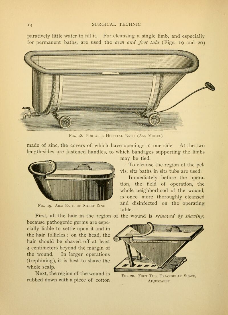 paratively little water to fill it. For cleansing a single limb, and especially for permanent baths, are used the arm and foot tubs (Figs. 19 and 20) Fig. 18. Portable Hospital Bath (Am. Model) made of zinc, the covers of which hav length-sides are fastened handles, to w Fig. 19. Arm Bath of Sheet Zinc First, all the hair in the region of because pathogenic germs are espe- cially liable to settle upon it and in the hair follicles; on the head, the hair should be shaved off at least 4 centimeters beyond the margin of the wound. In larger operations (trephining), it is best to shave the whole scalp. Next, the region of the wound is rubbed down with a piece of cotton e openings at one side. At the two hich bandages supporting the limbs may be tied. To cleanse the region of the pel- vis, sitz baths in sitz tubs are used. Immediately before the opera^ tion, the field of operation, the whole neighborhood of the wound, is once more thoroughly cleansed and disinfected on the operating table, the wound is removed by shaving, Fig. 20. Foot Tib, Triangl'lar Shape, Adjustable