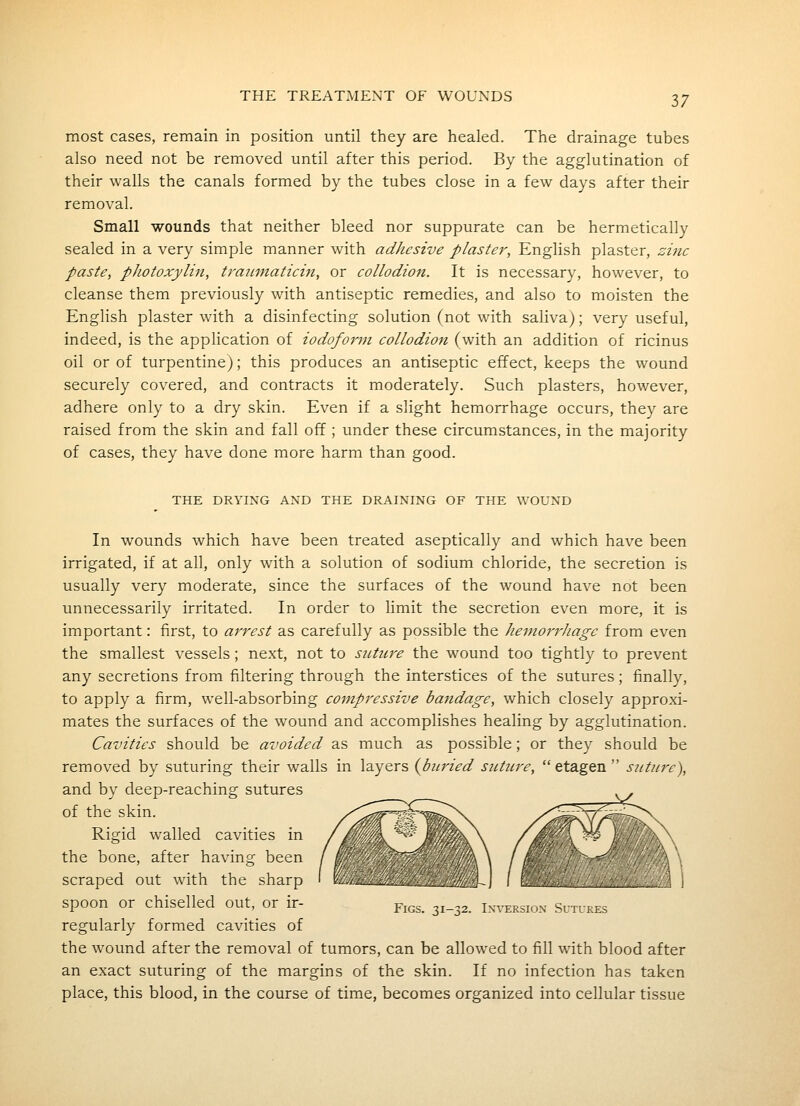 most cases, remain in position until they are healed. The drainage tubes also need not be removed until after this period. By the agglutination of their walls the canals formed by the tubes close in a few days after their removal. Small wounds that neither bleed nor suppurate can be hermetically sealed in a very simple manner with adhesive plaster, English plaster, zi?ic paste, pJiotoxylin, ti-aitniaticin, or collodion. It is necessary, however, to cleanse them previously with antiseptic remedies, and also to moisten the English plaster with a disinfecting solution (not with saliva); very useful, indeed, is the application of iodoform collodion (with an addition of ricinus oil or of turpentine); this produces an antiseptic effect, keeps the wound securely covered, and contracts it moderately. Such plasters, however, adhere only to a dry skin. Even if a slight hemorrhage occurs, they are raised from the skin and fall off; under these circumstances, in the majority of cases, they have done more harm than good. THE DRYING AND THE DRAINING OF THE WOUND In wounds which have been treated aseptically and which have been irrigated, if at all, only with a solution of sodium chloride, the secretion is usually very moderate, since the surfaces of the wound have not been unnecessarily irritated. In order to limit the secretion even more, it is important: first, to arrest as carefully as possible the hemorrhage from even the smallest vessels; next, not to suture the wound too tightly to prevent any secretions from filtering through the interstices of the sutures; finally, to apply a firm, well-absorbing compressive bandage, which closely approxi- mates the surfaces of the wound and accomplishes healing by agglutination. Cavities should be avoided as much as possible; or they should be removed by suturing their walls in layers {buried suture,  etagen  suture), and by deep-reaching sutures of the skin. Rigid walled cavities in the bone, after having been scraped out with the sharp spoon or chiselled out, or ir- f-j^s. 31-32. Inversion- SuTri.E., regularly formed cavities of the wound after the removal of tumors, can be allowed to fill with blood after an exact suturing of the margins of the skin. If no infection has taken place, this blood, in the course of time, becomes organized into cellular tissue