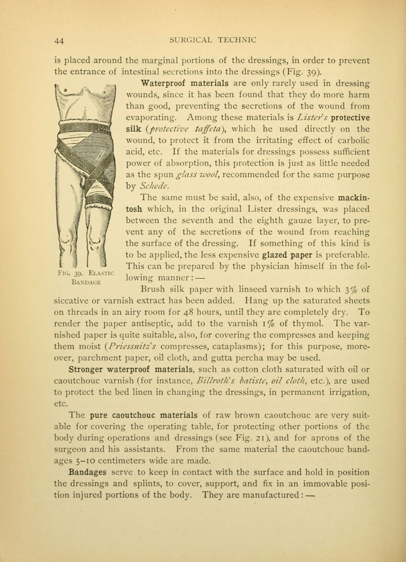 % .N^^wwm^ El AiIIC is placed around the marginal portions of the dressings, in order to prevent the entrance of intestinal secretions into the dressings (Fig. 39). Waterproof materials are only rarely used in dressing wounds, since it has been found that they do more harm than good, preventing the secretions of the wound from .. _-_ , evaporating. Among these materials is Z/i'/'rr'x protective rliiL—J-lfliS silk {protective taffeta), which he used directly on the wound, to protect it from the irritating effect of carbolic acid, etc. If the materials for dressings possess sufficient power of absorption, this protection is just as little needed as the spun glass zuool, recommended for the same purpose by ScJiede. The same must be said, also, of the expensive mackin- tosh which, in the original Lister dressings, was placed between the seventh and the eighth gauze layer, to pre- vent any of the secretions of the wound from reaching the surface of the dressing. If something of this kind is to be applied, the less expensive glazed paper is preferable. This can be prepared by the physician himself in the fol- lowing manner: — Brush silk paper with linseed varnish to which 3% of siccative or varnish extract has been added. Hang up the saturated sheets on threads in an airy room for 48 hours, until they are completely dry. To render the paper antiseptic, add to the varnish i % of thymol. The var- nished paper is quite suitable, also, for covering the compresses and keeping them moist {Priessjiitas compresses, cataplasms); for this purpose, more- over, parchment paper, oil cloth, and gutta percha may be used. Stronger waterproof materials, such as cotton cloth saturated with oil or caoutchouc varnish (for instance, BillrotJis batiste, oil cloth, etc.), are used to protect the bed linen in changing the dressings, in permanent irrigation, etc. The pure caoutchouc materials of raw brown caoutchouc are very suit- able for covering the operating table, for protecting other portions of the body during operations and dressings (see Fig. 21), and for aprons of the surgeon and his assistants. From the same material the caoutchouc band- ages 5-10 centimeters wide are made. Bandages serve to keep in contact with the surface and hold in position the dressings and splints, to cover, support, and fix in an immovable posi- tion injured portions of the body. They are manufactured: — Ba.nd.\ge