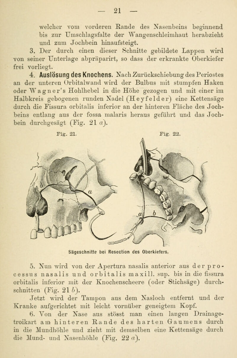 welcher vom vorderen Rande des Nasenbeins beginnend bis zur TJmsclilagsfalte der AYangenschieimliaut herabzieht und zum Jochbein hinaufsteigt. 3. Der durch einen dieser Schnitte gebildete Lappen wird von seiner Unterlage abpräparirt, so dass der erkrankte Oberkiefer frei vorliegt. 4. Auslösung des Knochens. Nach Zurückschiebung des Periostes an der unteren Orbitalwand wird der Bulbus mit stumpfen Haken oder Wagner's Hohlhebel in die Höhe gezogen und mit einer im Halbkreis gebogenen runden Nadel (Heyfeider) eine Kettensäge durch die Fissura orbitalis inferior an der hinteren Fläche des Joch- beins entlang aus der fossa malaris heraus geführt und das Joch- bein durchgesägt (Fig. 21 «). Fig. 21. Fig. 22. Sägeschnitte bei Resection des Oberkiefers. 5. Nun wird von der Apertura nasalis anterior aus der pro- cessus nasalis und orbitalis maxi 11. sup. bis in die fissura orbitalis inferior mit der Knochenscheere (oder Stichsäge) durch- schnitten (Fig. 21 l)). Jetzt wird der Tampon aus dem Nasloch entfernt und der Kranke aufgerichtet mit leicht vornüber geneigtem Kopf. 6. Von der Nase aus stösst man einen laugen Drainage- troikart am hinteren Rande des harten Gaumens durch in die Mundhöhle und zieht mit demselben eine Kettensäge durch die Mund- und Nasenhöhle (Fig. 22 rt).