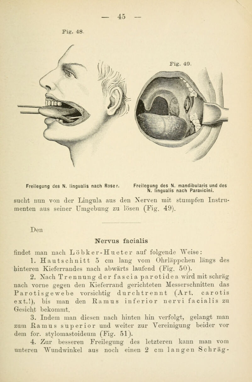 Fig. 48. Fig. 48. Freilegung des N. lingualis nach Roser. Freilegung des N. mandibularis und des N. lingualis nach Paravicini. sucht nun von der Lingula aus den Nerven mit stumpfen Instru- menten aus seiner Umgebung zu lösen (Fig. 49). Den Nervus facialis findet man nach Löbker-Hueter auf folgende AYeise: 1. Haut schnitt 5 cm lang vom Ohrläppchen längs des hinteren Kieferraudes nach abwärts laufend (Fig. 50). 2. Nach Trennung der fascia parotidea wird mit schräg nach vorne eesfen den Kieferrand o-erichteten Messerschnitten das Parotisgewebe vorsichtig durch trennt (Art. carotis ext.!), bis man den Ramus inferior nervi facialis zu Gesicht bekommt. 3. Indem man diesen nach hinten hin verfolgt, gelangt man zum ßamus superior und weiter zur Vereinigung beider vor dem for. stylomastoideum (Fig. 51). 4. Zur besseren Freilegung des letzteren kann man vom unteren Wundwinkel aus noch einen 2 cm langen Schräg-