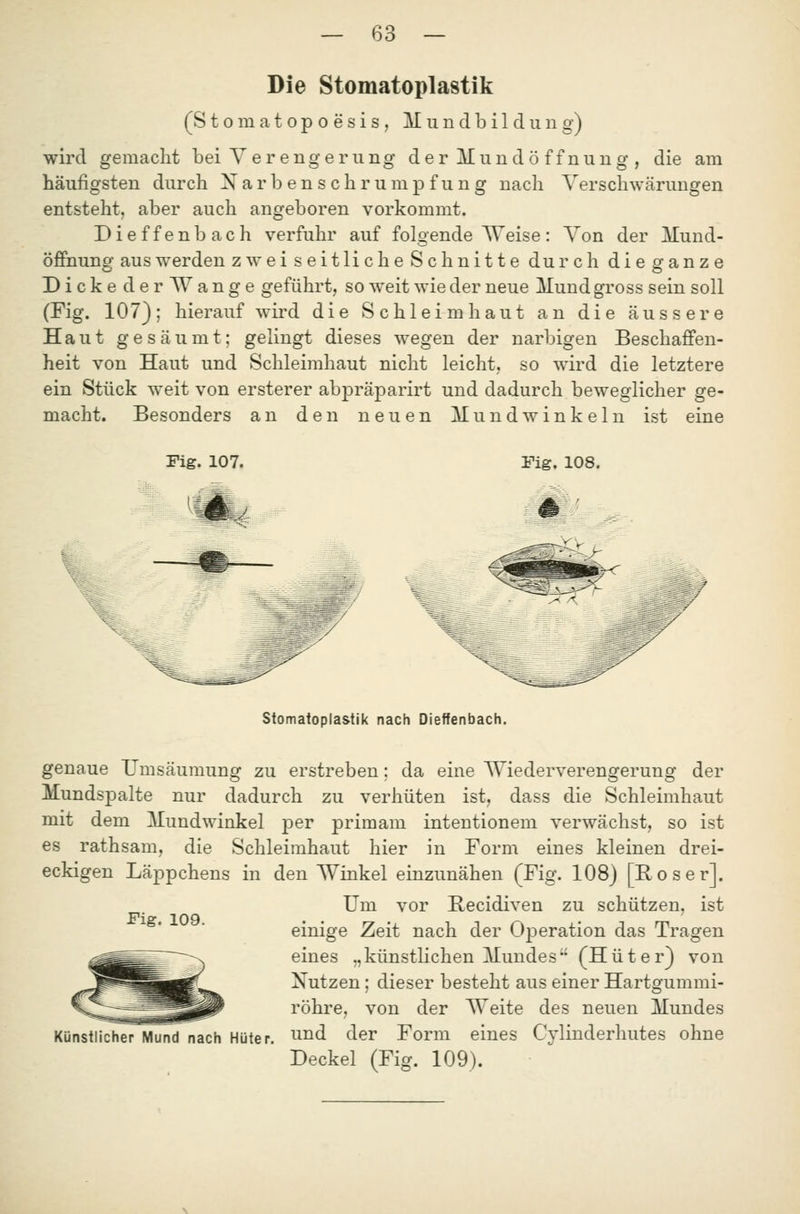 Die Stomatoplastik (Stomatopoesis, Mundbildung) wird gemacht bei Verengerung d e r Muu dö ff nung , die am häufigsten durch Xar b en s ehr ump f u n g nach Verschwärungen entsteht, aber auch angeboren vorkommt. Dieffenbach verfuhr auf folgende Weise: Von der Mund- öffnune* aus werden zw ei seitliche Schnitte durch diegfanze Dicke d erWange geführt, so weit wie der neue Mund gross sein soll (Fig. 107); hierauf wird die Schleimhaut an die äussere Haut gesäumt; gelingt dieses wegen der narbigen Beschaffen- heit von Haut und Schleimhaut nicht leicht, so wird die letztere ein Stück weit von ersterer abpräparirt und dadurch beweglicher ge- macht. Besonders an den neuen Mundwinkeln ist eine Fig. 107. Fig. 108. 'i^ / Stomatoplastik nach Dieffenbach. genaue Umsäumung zu erstreben; da eine Wiederverengerung der Mundspalte nur dadurch zu verhüten ist, dass die Schleimhaut mit dem Mundwinkel per primam intentionem verwächst, so ist es rathsam, die Schleimhaut hier in Form eines kleinen drei- eckigen Läppchens in den Winkel einzunähen (Fig. 108) [Roser]. Um vor Recidiven zu schützen, ist einige Zeit nach der Operation das Tragen eines „künstlichen Mundes (Hüter} von Nutzen; dieser besteht aus einer Hartgummi- röhre, von der Weite des neuen Mundes Künstlicher Mund nach Hüter, und der Form eines Cylinderhutes ohne Deckel (Fig. 109). Fig. 109.