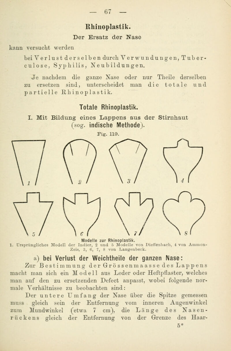 \ — 67 — ßhiuoplastik. Der Ersatz der Nase kann versucht werden bei Verlust derselben durch Verwundungen, Tuber- culosen Syphilis, Neubildungen. Je nachdem die ganze Xase oder nur Theile derselben zu ersetzen sind, unterscheidet man die totale und partielle E, h i n o p 1 a s t i k. Totale Rhinoplastik. I. Mit Bildung eines Lappens aus der Stirnhaut (sog. indische Methode). Fig. 119. Modelle zur Rhinoplastik. 1. Ursprüngliches Modell der Indier, 2 uud 5 Modelle von Dieffenbach, 4 von Ammon- Zeis, 3, 6, 7, S von Langenbeck. a) bei Verlust der Weichtheile der ganzen Nase: Zur Bestimmung der Grössenmaasse des Lappens macht man sich ein Modell aus Leder oder HeftjDÜaster, welches man auf den zu ersetzenden Defect anpasst, wobei folgende nor- male Verhältnisse zu beobachten sind: Der untere L^mfang der Nase über die Spitze gemessen muss gleich sein der Entfernung vom inneren Augenwinkel zum Mundwinkel (etwa 7 cm), die Länge des Nasen- rückens gleich der Entfernung von der Grenze des Haar-