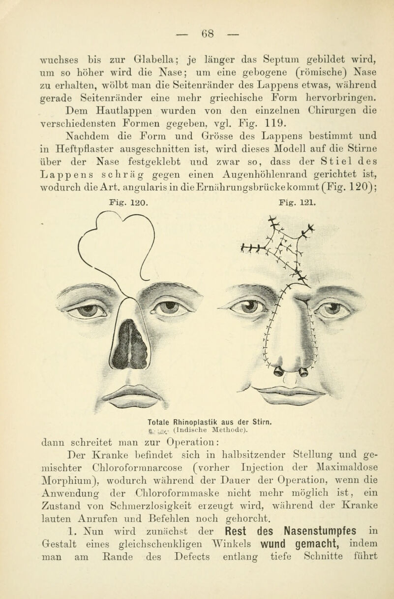 Wuchses bis zur Glabella; je länger das Septum gebildet wird, um so höher wird die Nase; um eine gebogene (römische) Nase zu erhalten, wölbt man die Seitenränder des Lappens etwas, während gerade Seitenränder eine mehr griechische Form hervorbringen. Dem Hautlappen wurden von den einzelnen Chirurgen die verschiedensten Formen gegeben, vgl. Fig. 119. Nachdem die Form und Grösse des Lappens bestimmt und in Heftpflaster ausgeschnitten ist, wird dieses Modell auf die Stirne über der Nase festgeklebt und zwar so, dass der Stiel des Lappens schräg gegen einen Augenhöhlenrand gerichtet ist, wodurch die Art. angularis in die Ernährungsbrücke kommt (Fig. 120); Fig. 120. Fig. 121. Totale Rhinoplastik aus der Stirn. S.' Li./.' (Indische Methode). dann schreitet man zur Operation: Der Kranke befindet sich in halbsitzender Stellung und ge- mischter Chloroforranarcose (vorher Injection der Maximaldose Morphium), wodurch während der Dauer der Operation, wenn die Anwendung der Chloroformmaske nicht mehr möglich ist, ein Zustand von Schmerzlosigkeit erzeugt wird, während der Kranke lauten Anrufen und Befehlen noch gehorcht. 1. Nun wird zunächst der Rest deS NasenstumpfeS in Gestalt eines gleichschenkligen Winkels WUnd gemacht, indem man am Rande des Defects entlang tiefe Schnitte führt