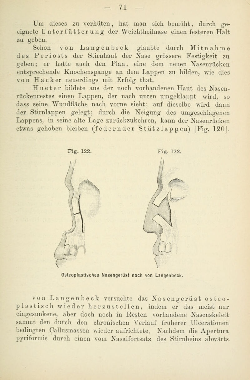 Um dieses zu verhüten, hat man sich bemüht, durch ge- eignete unter fütt er ung der Weichtheilnase einen festeren Halt zu geben. Schon von Langenbeck glaubte durch Mitnahme des Periosts der Stirnhaut der Nase grössere Festigkeit zu geben; er hatte auch den Plan, eine dem neuen Nasenrücken entsprechende Knochenspange an dem Lappen zu bilden, wie dies von Hacker neuerdings mit Erfolg that. H u e t e r bildete aus der noch vorhandenen Haut des Nasen- rückenrestes einen Lappen, der nach unten umgeklappt wird, so dass seine Wundfläche nach vorne sieht; auf dieselbe wird dann der Stirnlappen gelegt; durch die Neigung des umgeschlagenen Laf)pens, in seine alte Lage zurückzukehren, kann der Nasenrücken etwas gehoben bleiben (federnder Stütz läppen) [Fig. 120]. Fig. 122. Fig. 123. Osteoplastisches Nasengerüst nach von Langenbeck. von Langenbeck versuchte das Nasengerüst osteo- plastisch wieder herzustellen, indem er das meist nur eingesunkene, aber doch noch in Resten vorhandene Nasenskelett sammt den durch den chronischen Verlauf früherer TJlcerationen bedingten Callusmassen wieder aufrichtete. Nachdem die Apertura pyriformis durch einen vom Nasalfortsatz des Stirnbeins abwärts-