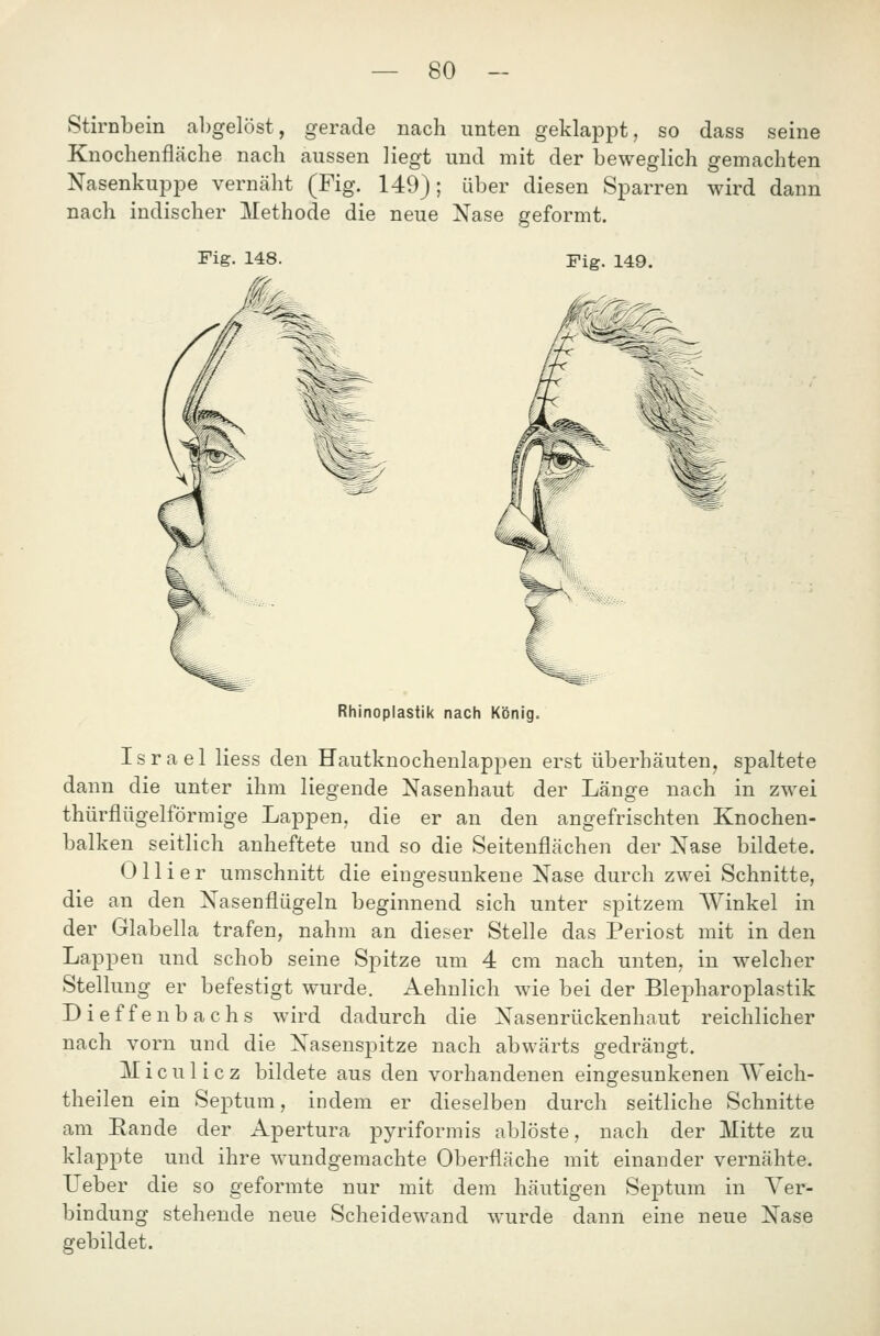 Stirnbein abgelöst, gerade nach unten geklappt, so dass seine Knochenfläche nach aussen liegt und mit der beweglich gemachten Nasenkuppe vernäht (Fig. 149); über diesen Sparren wird dann nach indischer Methode die neue Nase geformt. Fig. 149. Rhinoplastik nach König. Israel Hess den Hautknochenlappen erst überhäuten, spaltete dann die unter ihm liegende Nasenhaut der Länge nach in zwei thürflügelförmige Lappen, die er an den angefrischten Knochen- balken seitlich anheftete und so die Seitenflächen der Nase bildete. 011 i e r umschnitt die eingesunkene Nase durch zwei Schnitte, die an den Nasenflügeln beginnend sich unter spitzem Winkel in der Glabella trafen, nahm an dieser Stelle das Periost mit in den Lappen und schob seine Spitze um 4 cm nach unten, in welcher Stellung er befestigt wurde. Aehnlich wie bei der Blepharoplastik Dieffenbachs wird dadurch die Nasenrückenhaut reichlicher nach vorn und die Nasenspitze nach abwärts gedrängt. lliculicz bildete aus den vorhandenen eingesunkenen Weich- theilen ein Septum, indem er dieselben durch seitliche Schnitte am Eande der Apertura pyriformis ablöste, nach der Mitte zu klappte und ihre wundgemachte Oberfläche mit einander vernähte, lieber die so geformte nur mit dem häutigen Septum in Ver- bindung stehende neue Scheidewand wurde dann eine neue Nase gebildet.