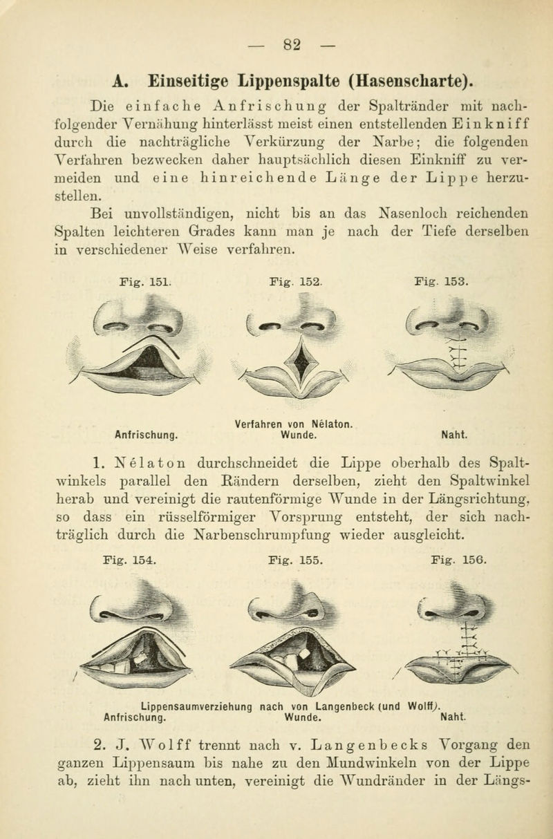 A. Einseitige Lippenspalte (Hasenscharte). Die einfache An frischung der Spaltränder mit nach- folgender Yernähung hinterlässt meist einen entstellenden Einkniff durch die nachträgliche Verkürzung der Narbe; die folgenden Verfahren bezwecken daher hauptsächlich diesen Einkniff zu ver- meiden und eine hinreichende Länge der Lippe herzu- stellen. Bei unvollständigen, nicht bis an das Nasenloch reichenden Spalten leichteren Grades kann man je nach der Tiefe derselben in verschiedener Weise verfahren. Fig. 151. Fig. 152. Fig. 153. Anfrischung. Verfahren von Nelaton. Wunde. Naht. 1. Nelaton durchschneidet die Lippe oberhalb des Spalt- winkels parallel den Kändern derselben, zieht den Spaltwinkel herab und vereinigt die rautenförmige Wunde in der Längsrichtung, so dass ein rüsselförmiger Vorsprung entsteht, der sich nach- träglich durch die Narbenschrumpfung wieder ausgleicht. Fig. 154. Fig. 155. Fig. 156. Lippensaumverziehung nach von Langenbeck (und Wolff^. Anfrischung. Wunde. Naht. 2. J. Wolff trennt nach v. Langenbecks Vorgang den ganzen Lippensaum bis nahe zu den Mundwinkeln von der Lippe ab, zieht ihn nach unten, vereinigt die Wundräuder in der Längs-