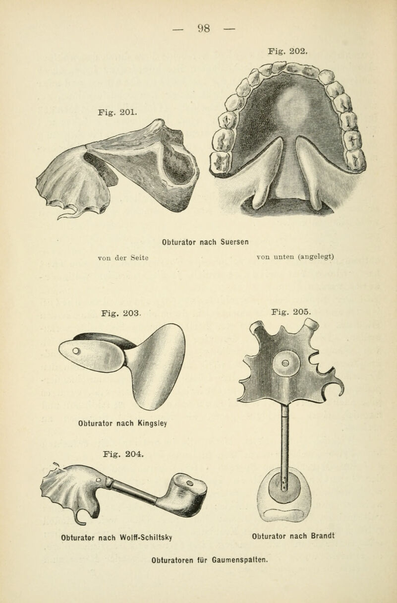 Fig. 201 Obturator nach Suersen von der Seite von unten (angelegt) Fig. 203. Fig. 205. Obturator nach Kingsley Fig. 204. w Obturator nach Woltf-Schiltsky Obturator nach Brandt Obturatoren für Gaumenspalten.