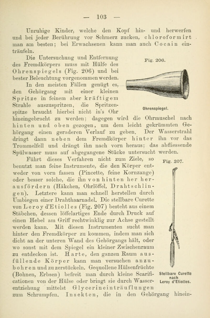 Fig. 206. Unruhige Kinder, welche den Kopf hin- und herwerfen und bei jeder Berührung vor Schmerz zucken, chloroformirt man am besten; bei Erwachsenen kann man auch Cocain ein- träufeln. Die Untersuchung und Entfernung des Fremdkörpers muss mit Hülfe des Ohrensp iegels (Fig. 206) und bei bester Beleuchtung vorgenommen werden. In den meisten Fällen genügt es, den Gehörgang mit einer kleinen Spritze in feinem aber kräftigem Strahle auszuspritzen, die Spritzen- spitze braucht hierbei nicht ins Ohr hineingebracht zu werden; dagegen wird die Ohrmuschel nach hinten und oben gezogen, um dem leicht gekrümmten Gre- Wasserstrahl ihn vor das Ohrenspiegel. hörgang drinoft gezogen, um einen geraderen Verlauf zu geben, dann neben dem Fremdkörper hinter Der Fig. 207. Trommelfell und drängt ihn nach vorn heraus; das abfliessende Spülwasser muss auf abgegangene Stücke untersucht werden. Führt dieses Verfahren nicht zum Ziele, so benutzt man feine Instrumente, die den Körper ent- weder von vorn fassen (Pincette, feine Kornzange) oder besser solche, die ihn von hinten her her- ausfördern (Häkchen, Ohrlöffel, Draht schlin- gen). Letztere kann man schnell herstellen durch Umbiesfen einer Drahthaarnadel. Die stellbare Curette von L e r 0 y d'E t i o 11 e s (Fig. 207) besteht aus einem Stäbchen, dessen löffelartiges Ende durch Druck auf einen Hebel am OrifF rechtwinklig zur Achse gestellt werden kann. Mit diesen Instrumenten sucht man hinter den Fremdkörper zu kommen, indem man sich dicht an der unteren Wand des Gehörgangs hält, oder wo sonst mit dem Spiegel ein kleiner Zwischenraum zu entdecken ist. Harte, den ganzen Raum aus- füllende Körper kann man versuchen anzu- bohren und zu zerstückeln. Gequollene Hülsenfrüchte (Bohnen, Erbsen) befreit man durch kleine Scarifi- cationen von der Hülse oder bringt sie durch W^asser- entziehung mittelst Gly cer in ein träufln n gen zum Schrumpfen. Insekten, die in den Gehörgang % Stellbare Curette nach Leroy d'Etiolles. hinein-