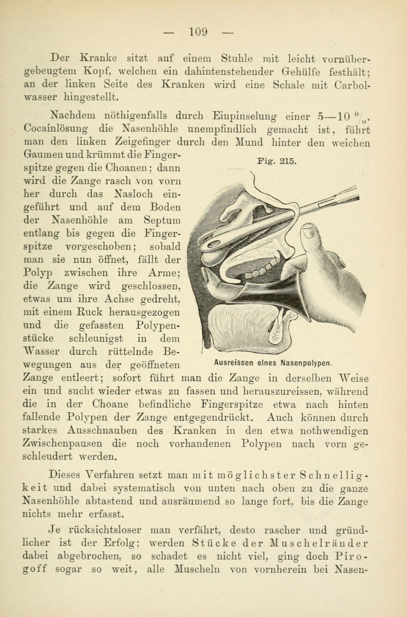 Der Kranke sitzt auf einem Stuhle mit leicht vornüber- gebeugtem KojDf, welchen ein dahintenstehender Gehülfe festhält; an der linken Seite des Kranken wird eine Schale mit Carbol- wasser hingestellt. Nachdem nöthigenfalls durch Eiupinselung einer 5—10 ^ . Cocainlösung die Nasenhöhle unempfindlich gemacht ist, führt man den linken Zeigefinger durch den Mund hinter den weichen Gaumen und krümmt die Fino'er- „. Fig. 215. spitze gegen die Choanen; dann wird die Zange rasch \on vorn her durch das Nasloch ein- geführt und auf dem Boden der Nasenhöhle am Septum entlang bis gegen die Finger- spitze vorgeschoben; sobald man sie nun öffnet, fällt der Polyj) zwischen ihre Arme; die Zange wird geschlossen, etwas um ihre Achse gedreht, mit einem Kuck herausgezogen und die gefassten Polypen- stücke schleunio'st in dem Wasser durch rüttelnde Be- wegungen aus der geöffneten Ausreissen eines Nasenpolypen. Zange entleert; sofort führt man die Zange in derselben Weise ein und sucht wieder etwas zu fassen und herauszureissen, während die in der Choane befindliche Fingerspitze etwa nach hinten fallende Polypen der Zange entgegendrückt. Auch können durch starkes Ausschnauben des Krauken in den etwa nothwendigen Zwischenpausen die noch vorhandenen Polypen nach vorn ge- schleudert werden. Dieses Verfahren setzt man mit m ö ö' 1 i c h s t e r S c h n e 11 i o- - keit und dabei systematisch von unten nach oben zu die ganze Nasenhöhle abtastend und ausräumend so lange fort, bis die Zange nichts mehr erfasst. Je rücksichtsloser lieber ist der Erfolg; dabei abgebrochen, so goff sogar so weit, man verfährt, desto rascher und gründ- werden Stücke der Muschelränder schadet es nicht viel, ging doch Piro- alle Muscheln von vornherein bei Nasen-