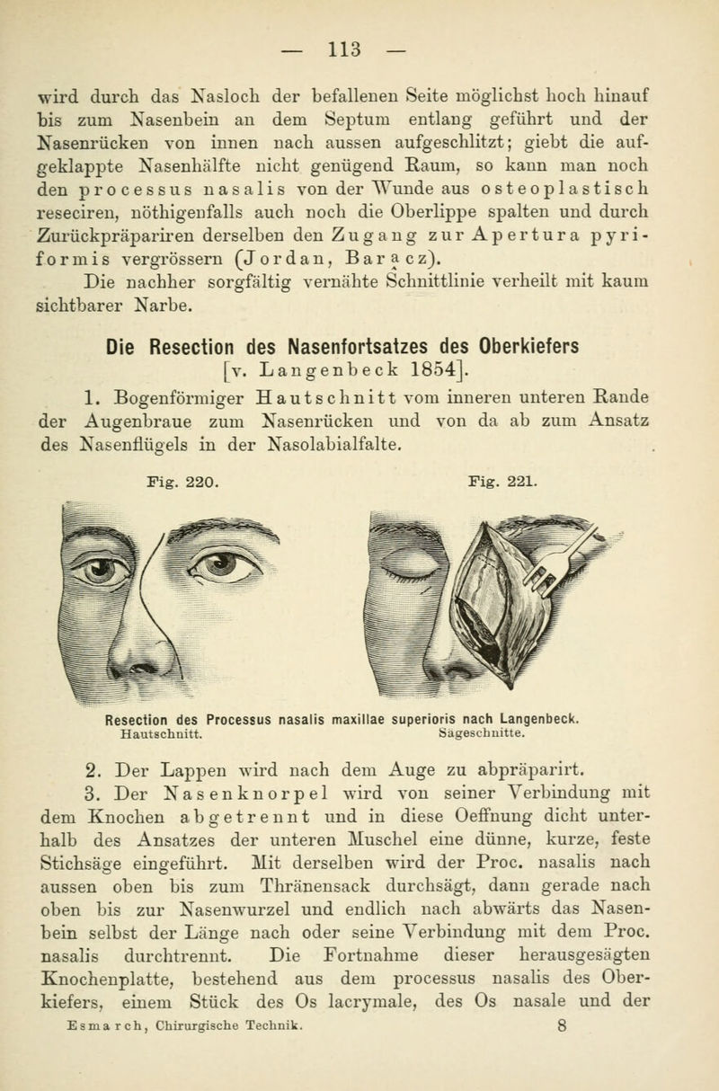 wird durch das Naslocli der befalleDen Seite möglichst hoch hinauf bis zum Nasenbein an dem Septum entlang geführt und der Nasenrücken von innen nach aussen aufgeschlitzt; giebt die auf- geklappte Nasenhälfte nicht genügend Raum, so kann man noch den Processus nasalis von der Wunde aus osteoplastisch reseciren, nöthigenfalls auch noch die Oberlippe spalten und durch Zurückpräparii'cn derselben den Zugang zurApertura pyri- formis vergrössern (Jordan, Baracz). Die nachher sorgfältig vernähte Schnittlinie verheilt mit kaum sichtbarer Narbe. Die Resection des Nasenfortsatzes des Oberkiefers [v. Langenbeck 1854]. 1. Bogenförmiger Hautschnitt vom inneren unteren Rande der Augenbraue zum Nasenrücken und von da ab zum Ansatz des Nasenflügels in der Nasolabialfalte. Fig. 220. Fig. 221. Resection des Processus nasalis maxiilae superioris nacli Langenbeck. Hautschnitt. Sägeschuitte. 2. Der Lappen wird nach dem Auge zu abpräparirt. 3. Der Nasenknorpel wird von seiner Verbindung mit dem Knochen abgetrennt und in diese Oeffnung dicht unter- halb des Ansatzes der unteren Muschel eine dünne, kurze, feste Stichsäse eingeführt. Mit derselben wird der Proc. nasalis nach aussen oben bis zum Thränensack durchsägt, dann gerade nach oben bis zur Nasenwurzel und endlich nach abwärts das Nasen- bein selbst der Länge nach oder seine Verbindung mit dem Proc. nasalis durchtrennt. Die Fortnahme dieser herausgesägten Knochenplatte, bestehend aus dem processus nasalis des Ober- kiefers, einem Stück des Os lacrymale, des Os nasale und der Esmarch, Chirurgische Technik. 8