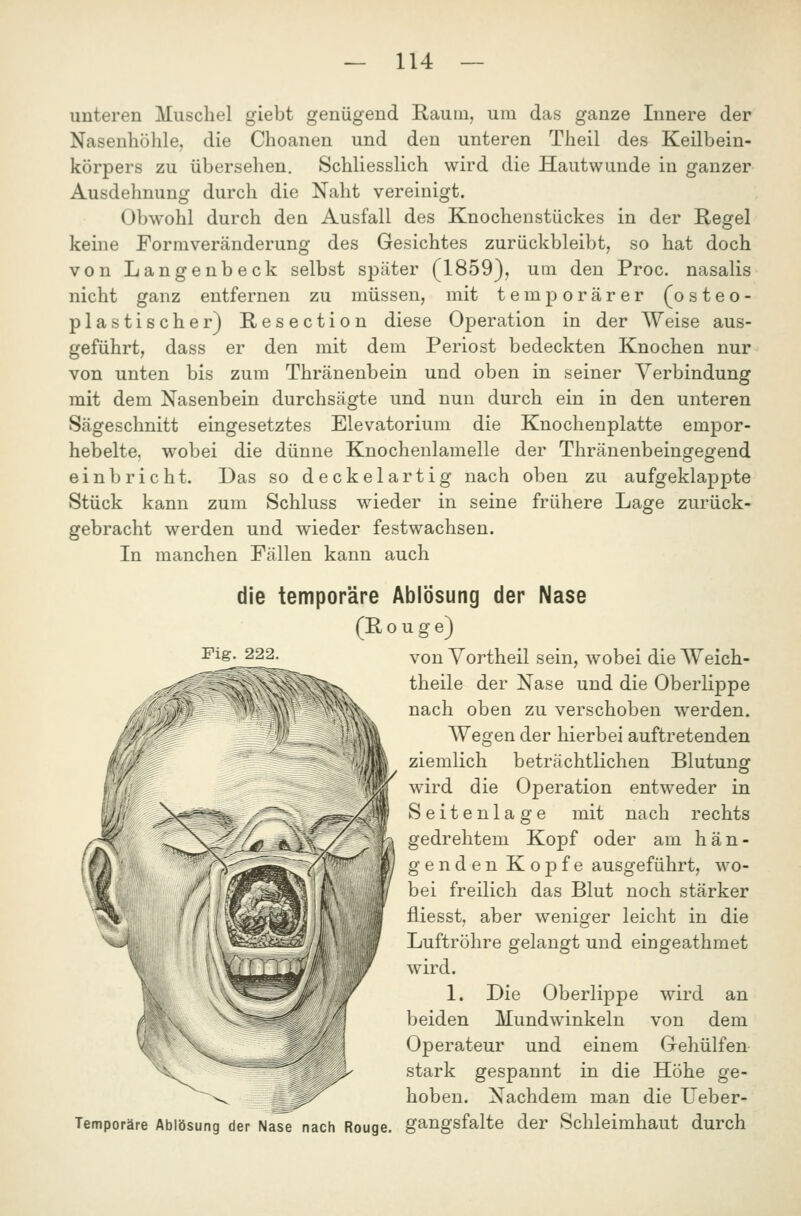 unteren Muschel giebt genügend Raum, um das ganze Innere der Nasenhöhle, die Choanen und den unteren Theil des Keilbein- körpers zu übersehen. Schliesslich wird die Hautwunde in ganzer Ausdehnung durch die Naht vereinigt. Obwohl durch den Ausfall des Knochenstückes in der Regel keine Forraveränderung des Gesichtes zurückbleibt, so hat doch von Langenbeck selbst später (1859), um den Proc. nasalis nicht ganz entfernen zu müssen, mit temporärer (osteo- plastischer) Resection diese Operation in der Weise aus- geführt, dass er den mit dem Periost bedeckten Knochen nur von unten bis zum Thränenbein und oben in seiner Verbindung mit dem Nasenbein durchsägte und nun durch ein in den unteren Sägeschnitt eingesetztes Elevatorium die Knochenplatte empor- hebelte, wobei die dünne Knochenlamelle der Thränenbeingegend einbricht. Das so deckelartig nach oben zu aufgeklajDpte Stück kann zum Schluss wieder in seine frühere Lage zurück- gebracht werden und wieder festwachsen. In manchen Fällen kann auch die temporäre Ablösung der Nase (Rouge) von Yortheil sein, wobei die Weich- theile der Nase und die Oberlippe nach oben zu verschoben werden. Wegen der hierbei auftretenden ziemlich beträchtlichen Blutung wird die Operation entweder in Seitenlage mit nach rechts gedrehtem Kopf oder am hän- genden Kopfe ausgeführt, wo- bei freilich das Blut noch stärker fliesst, aber weniger leicht in die Luftröhre gelangt und eingeathmet wdrd. 1. Die Oberlippe wird an beiden Mundwinkeln von dem Operateur und einem Grehülfen stark gespannt in die Höhe ge- hoben. Nachdem man die Ueber- Temporäre Ablösung der Nase nach Rouge, gangsfalte der Schleimhaut durch Fig. 222.