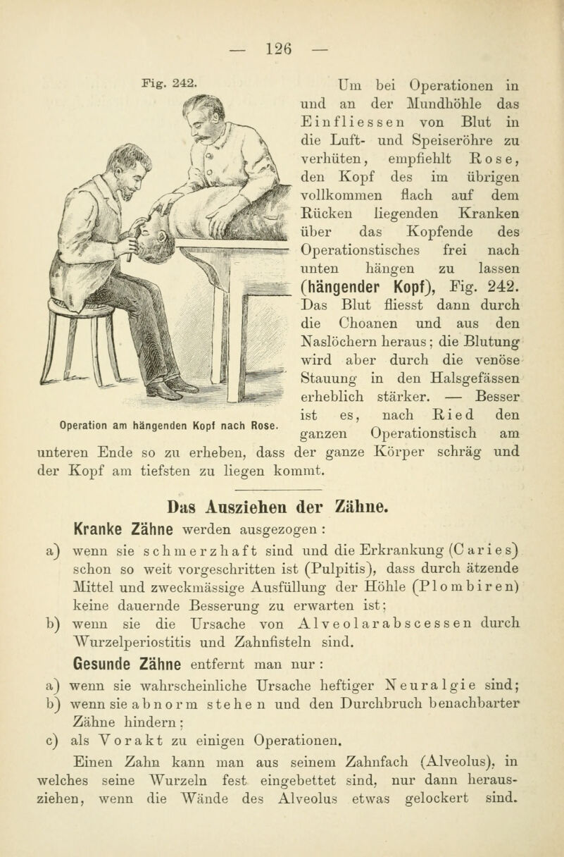 Fig. 242. Operation am hängenden Kopf nach Rose. Um bei Operationen in und an der Mundhöhle das Einfliessen von Blut in die Luft- und Speiseröhre zu verhüten, empfiehlt Rose, den Kopf des im übrigen vollkommen flach auf dem Kücken liegenden Kranken über das Kopfende des Operationstisches frei nach unten hängen zu lassen (hängender Kopf), Fig. 242. Das Blut fliesst dann durch die Choanen und aus den Naslöchern heraus ; die Blutung wird aber durch die venöse Stauung in den Halsgefässen erheblich stärker. — Besser ist es, nach B i e d den ganzen Operationstisch am unteren Ende so zu erheben, dass der ganze Körper schräg und der Kopf am tiefsten zu liegen kommt. Das Ausziehen der Zähne. Kranke Zähne werden ausgezogen : a) wenn sie schmerzhaft sind und die Erkrankung (C a r i e s) schon so weit vorgeschritten ist (Pulpitis), dass durch ätzende Mittel und zweckmässige Ausfüllung der Höhle (P1 o m b i r e n) keine dauernde Besserung zu erwarten ist; b) wenn sie die Ursache von Alveolarabscessen durch Wurzelperiostitis und Zahnfisteln sind. Gesunde Zähne entfernt man nur : a) wenn sie wahrscheinliche Ursache heftiger Neuralgie sind; b) wenn sie abnorm stehen und den Durchbruch benachbarter Zähne hindern: c) als y o r a k t zu einigen Operationen. Einen Zahn kann man aus seinem Zahnfach (Alveolus), in welches seine Wurzeln fest eingebettet sind, nur dann heraus- ziehen, wenn die Wände des Alveolus etwas gelockert sind.