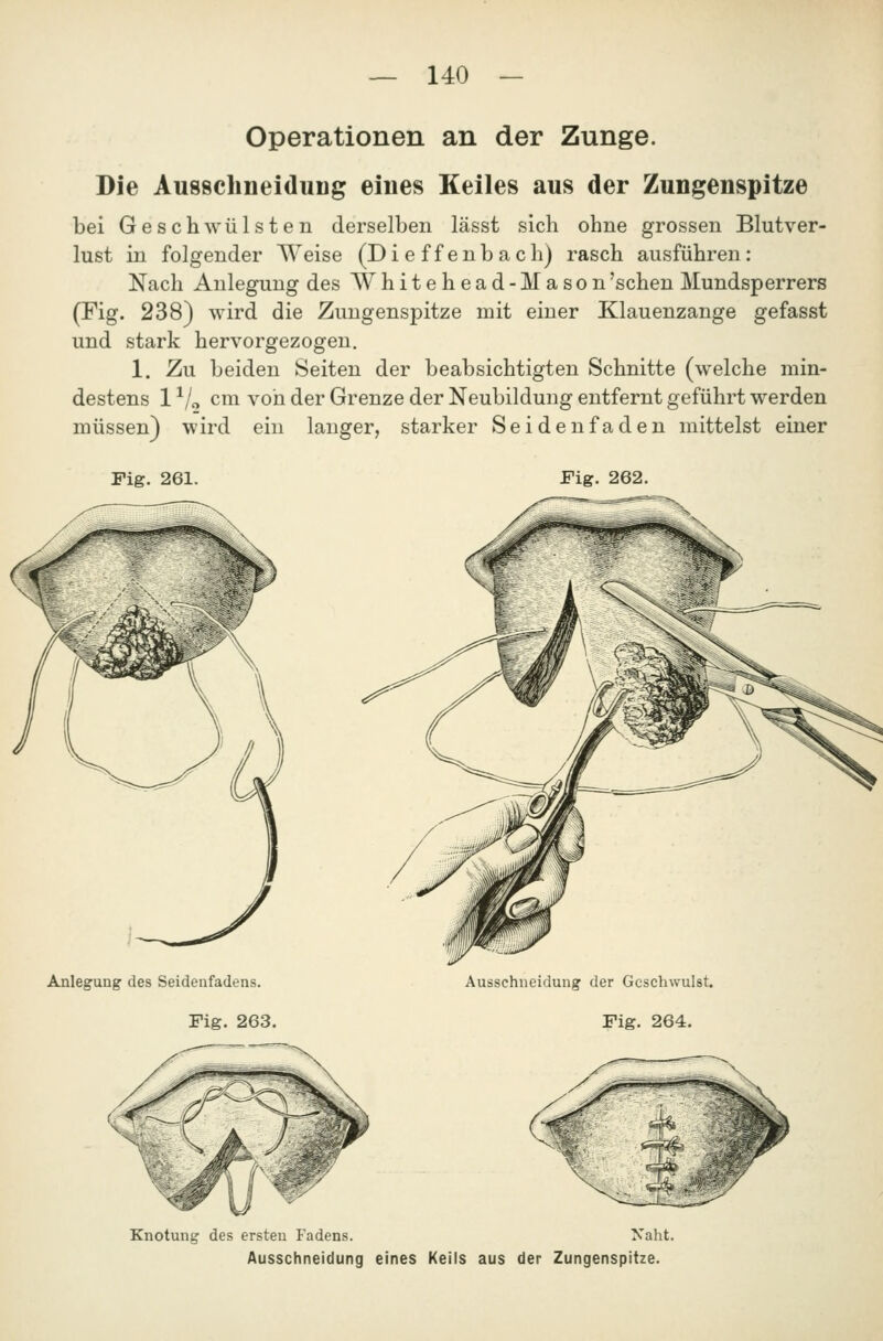 Operationen an der Zunge. Die Ausschneiduug eines Keiles aus der Zungenspitze bei Geschwülsten derselben lässt sich ohne grossen Blutver- lust in folgender Weise (Die ff enb ach) rasch ausführen: Nach Anlegung des Whitehead-Mason'sehen Mundsperrers (Fig. 238) wird die Zungenspitze mit einer Klauenzange gefasst und stark hervorgezogen. 1. Zu beiden Seiten der beabsichtigten Schnitte (welche min- destens 1 ^/c, cm von der Grenze der Neubildung entfernt geführt werden müssen) wird ein langer, starker Seiden faden mittelst einer Fig. 261. Fig. 262. Anlegung des Seidenfadens. Fig. 263. Ausschneidung der Geschwulst. Fig. 264. Knotung des ersten Fadens. Naht. Ausschneidung eines Keils aus der Zungenspitze.