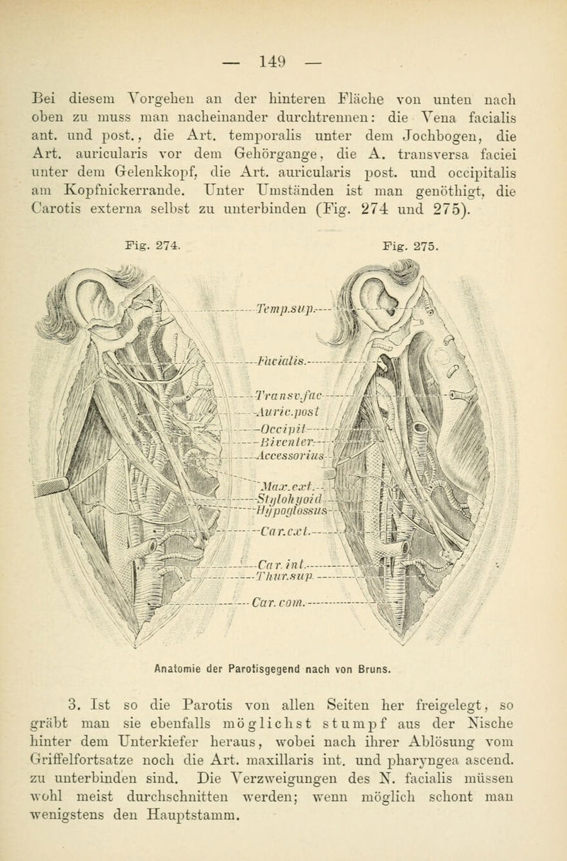 Bei diesem Vorgeben an der hinteren Fläche von unten nach oben zu niuss man nacheinander durchtrennen: die Vena facialis ant. und post., die Art. temjDoralis unter dem Jochbogen, die Art. auricularis vor dem Gehörgange, die A. transversa faciei unter dem Gelenkkoj^f, die Art. auricularis post. und occipitalis am Kopfnickerrande. Unter Umständen ist man genöthigt, die Carotis externa selbst zu unterbinden (Fig. 274 und 275). Fig. 274. Fig. 275. Temp.sup.-— *^*, Facialis. -Transv.fac- - -Äuric.post -Accessoi'ius j/'-^ (^1 n ~J\l -> StijloJiyokJ- ' t]i/poglossu& Ca r. ext— -Car. int. ■Thur.swp — Car.com. \ ;f. Anatomie der Parotisgegend nach von Bruns. 3. Ist SO die Parotis von allen Seiten her freigelegt, so gräbt man sie ebenfalls möglichst stumpf aus der Nische hinter dem Unterkiefer heraus, wobei nach ihrer Ablösung vom Griffelfortsatze noch die Art. maxillaris int. und pharyngea ascend. zu unterbinden sind. Die Verzweigungen des N. facialis müssen wohl meist durchschnitten werden; wenn möglich schont man wenigstens den Hauptstamm,