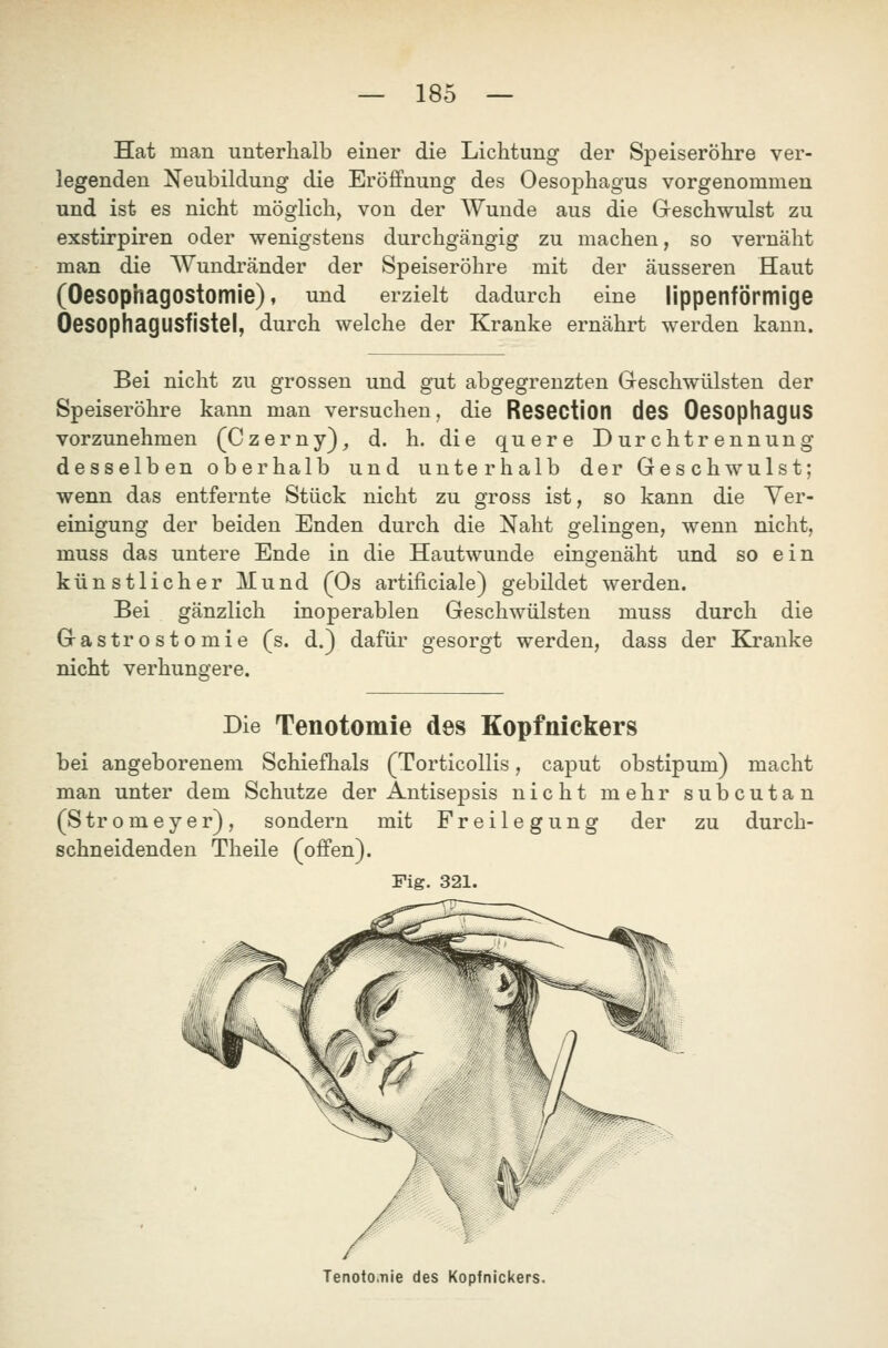 Hat man unterhalb einer die Lichtung der Speiseröhre ver- legenden Neubildung die Eröffnung des Oesophagus vorgenommen und ist es nicht möglich, von der Wunde aus die Geschwulst zu exstirpiren oder wenigstens durchgängig zu machen, so vernäht man die Wundränder der Speiseröhre mit der äusseren Haut (Oesophagostomie) ♦ und erzielt dadurch eine lippenförmige Oesophagusfistel, durch welche der Kranke ernährt werden kann. Bei nicht zu grossen und gut abgegrenzten G-eschwülsten der Speiseröhre kann man versuchen, die ReSGCtion deS Oesophagus vorzunehmen (Czerny), d. h. die quere Durchtrennung desselben oberhalb und unterhalb der Geschwulst; wenn das entfernte Stück nicht zu gross ist, so kann die Ver- einigung der beiden Enden durch die Naht gelingen, wenn nicht, muss das untere Ende in die Hautwunde eingenäht und so ein künstlicher Jltlund (Os artificiale) gebildet werden. Bei gänzlich inoperablen Geschwülsten muss durch die Gastrostomie (s. d.) dafür gesorgt werden, dass der Kranke nicht verhungere. Die Tenotomie des Kopfnickers bei angeborenem Schiefhals (Torticollis, caput obstipum) macht man unter dem Schutze der Antisepsis nicht mehr subcutan (Stromeyer), sondern mit Freileg ung der zu durch- schneidenden Theile (offen). Fig. 321. t 1 Tenoto.nie des Kopfnickers.