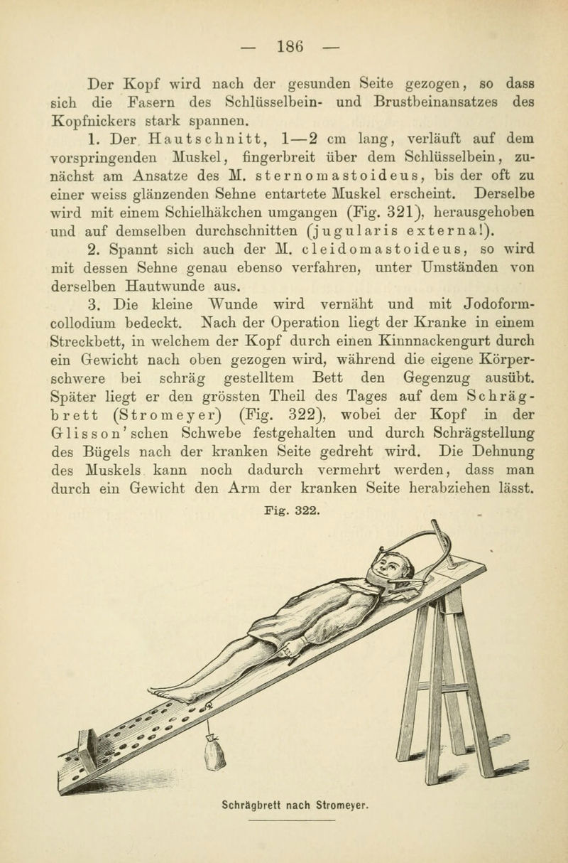 Der Kopf wird nacla der gesunden Seite gezogen, so dass sich die Fasern des Schlüsselbein- und Brustbeinansatzes des Kopfnickers stark spannen. 1. Der Hautschnitt, 1—2 cm lang, verläuft auf dem vorspringenden Muskel, fingerbreit über dem Schlüsselbein, zu- nächst am Ansätze des M. sternomastoideus, bis der oft zu einer weiss glänzenden Sehne entartete Muskel erscheint. Derselbe wird mit einem Schielhäkchen umgangen (Fig. 321), herausgehoben und auf demselben durchschnitten (jugularis externa!). 2. Sj)annt sich auch der M. cleidomastoideus, so wird mit dessen Sehne genau ebenso verfahren, unter Umständen von derselben Hautwunde aus. 3. Die kleine Wunde wird vernäht und mit Jodoform- collodium bedeckt. Nach der Operation liegt der Kranke in einem Streckbett, in welchem der Kopf durch einen Kinnnackengurt durch ein Gewicht nach oben gezogen wird, während die eigene Körper- schwere bei schräg gestelltem Bett den Gegenzug ausübt. Später liegt er den grössten Theil des Tages auf dem Schräg- brett (Stromeyer) (Fig. 322), wobei der Kopf in der Glisson' sehen Schwebe festgehalten und durch Schrägstellung des Bügels nach der kranken Seite gedreht wird. Die Dehnung des Muskels kann noch dadurch vermehrt werden, dass man durch ein Gewicht den Arm der kranken Seite herabziehen lässt. Fig. 322. Schrägbrett nach Stromeyer.