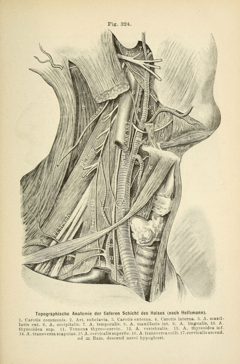 Topographische Anatomie der tieferen Schicht des Halses (nach Heltzmann). 1. Carotis communis. 2. Art. subclavia. 3. Carotis externa, i. Carotis interna. 5. A. maxil- laris ext. 6. A. occipitalis. 7. A. temporalis. S. A. maxillaris int. 9. A. lingualis. 10. A. thyreoidea sup. 11. Truncua tbyreo-cervic. 12. A. vertebralis. 13. A. tbyreoidea inf. 14. A. transversa scapulae. 15 A.cervicalissuperfic. 16. A. transversa colli. 17. cervicalisascend. ad =: Eam. descend nervi bypoglossi.