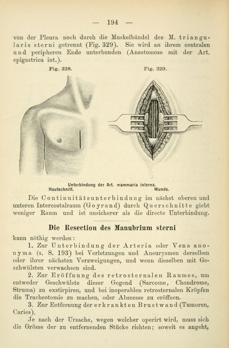 von der Pleura, noch durch die Muskelbündel des M. triangu- laris sterni getrennt (Fig. 329). Sie wird an ihrem centralen und peripheren Ende unterbunden (Anastomose mit der Art. epigastrica int.). Fig. 328. Fig. 329. ^  \^ Unterbindung der Art. mammaria interna. Hautschnitt. Wunde. Die ContinuitätsUnterbindung im nächst oberen und unteren Intercostalraum (Go yrand) durch Querschnitte giebt weniger Kaum und ist unsicherer als die directe Unterbindung. Die Resection des Manubrium sterni kann nöthig werden: 1. Zur Unterbindung der Arteria oder Vena ano- nyma (s. S. 193) bei Verletzungen und Aneurysmen derselben oder ihrer nächsten Verzweigungen, und wenn dieselben mit Ge- schwülsten verwachsen sind. 2. Zur Eröffnung des retrosternalen Raumes, um entweder Geschwülste dieser Gegend (Sarcome, Chondrome, Struma) zu exstirpiren, und bei inoperablen retrosternalen Kröpfen die Tracheotomie zu machen, oder Abscesse zu eröffnen. 3. Zur Entfernung der erkrankten Brust wand (Tumoren, Caries). Je nach der Ursache, wegen welcher operirt wird, muss sich die Grösse der zu entfernenden Stücke richten; soweit es angeht,