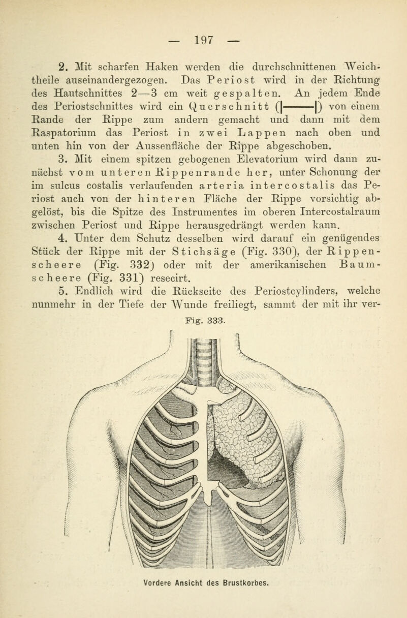 2. Mit scharfen Haken werden die diirchsclanittenen Weich- theile auseinandergezogen. Das Periost wird in der Kichtung des Hautschnittes 2—3 cm weit gespalten. An jedem Ende des Periostschnittes wird ein Querschnitt (| 1) von einem Rande der Hippe zum andern gemacht und dann mit dem Raspatorium das Periost in zwei Lappen nach oben und unten hin von der Aussenfläche der Rippe abgeschoben. 3. Mit einem spitzen gebogenen Elevatorium wird dann zu- nächst vom unteren Rippenrande her, unter Schonung der im sulcus costalis verlaufenden arteria intercostalis das Pe- riost auch von der hinteren Fläche der Rippe vorsichtig ab- gelöst, bis die Spitze des Instrumentes im oberen Intercostalraum zwischen Periost und Rippe herausgedrängt werden kann. 4. Unter dem Schutz desselben wird darauf ein genügendes Stück der Rippe mit der Stichsäge (Fig. 330), derRippen- scheere (Fig. 332) oder mit der amerikanischen Baum- so beere (Fig. 331) resecirt. 5. Endlich wird die Rückseite des Periostcylinders, welche nunmehr in der Tiefe der Wunde freiliegt, sammt der mit ihr ver- Fig. 333. Vordere Ansicht des Brustkorbes.