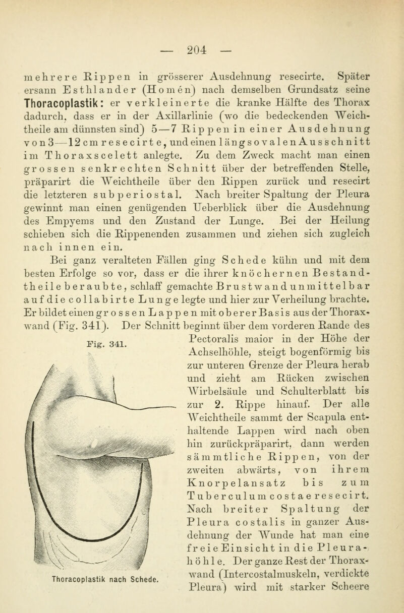 mehrere Rippen in grösserer Ausdehnung resecirte. Später ersann Est hl ander (Homen) nach demselben Grundsatz seine ThoraCOplastik: er verkleinerte die kranke Hälfte des Thorax dadurch, dass er in der Axillarlinie (wo die bedeckenden Weich- theile am dünnsten sind) 5 — 7 E,ip p en in einer Ausdehnung von 3 —12 cm resecirte, und einen längsovalenAusschnitt im Thoraxscelett anlegte. Zu dem Zweck macht man einen grossen senkrechten Schnitt über der betreffenden Stelle, 23räparirt die AVeichtheile über den Rippen zurück und resecirt die letzteren sub periostal. Nach breiter Spaltung der Pleura gewinnt man einen genügenden TJeberblick über die Ausdehnung des Empyems und den Zustand der Lunge. Bei der Heilung schieben sich die Rippenenden zusammen und ziehen sich zugleich nach innen ein. Bei ganz veralteten Fällen ging Schede kühn und mit dem besten Erfolge so vor, dass er die ihrer knö ehernen Best and- theileberaubte, schlaff gemachte Brust wandunmittelbar aufdie collabirte Lunge legte und hier zur Verheilung brachte. Er bildet einen gr ossenLappen mit oberer Basis aus der Thorax- wand (Fig. 341). Der Schnitt beginnt über dem vorderen Rande des Pectoralis maior in der Höhe der Achselhöhle, steigt bogenförmig bis zur unteren Grenze der Pleura herab und zieht am Rücken zwischen Wirbelsäule und Schulterblatt bis zur 2. Rippe hinauf. Der alle AVeichtheile sammt der Scapula ent- haltende Lappen wird nach oben hin zurückjDräparirt, dann werden sämmtliche Rippen, von der zweiten abwärts, von ihrem Knorpelansatz bis zum Tuberculumcostaeresecirt. Nach breiter Spaltung der Pleura costalis in ganzer Aus- dehnung der Wunde hat man eine freie Einsicht in die Pleura- h ö h 1 e. Der ganze Rest der Thorax- wand (Intercostalmuskeln, verdickte Pleura) wird mit starker Scheere Fig. 341. Thoracoplastik nach Schede.