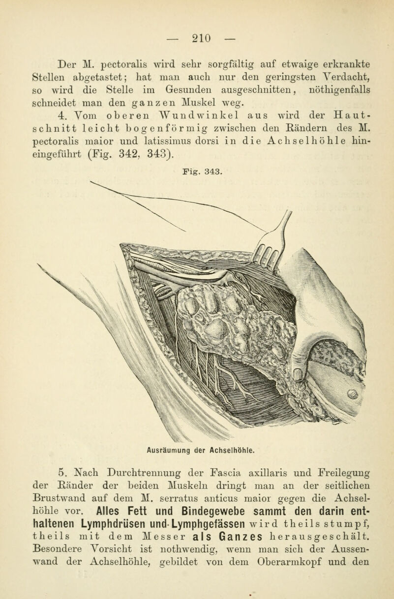 Der M. pectoralis wird sehr sorgfältig auf etwaige erkrankte Stellen abgetastet; hat man auch nur den geringsten Verdacht, so wird die Stelle im Gesunden ausgeschnitten, nöthigenfalls schneidet man den ganzen Muskel weg. 4. Vom oberen Wundwinkel aus wird der Haut- schnitt leicht bogenförmig zwischen den Rändern des M. pectoralis maior und latissimus dorsi in die Achselhöhle hin- eingeführt (Fig. 342, 343). Fig. 343. Ausräumung der Achselhöhle. 5. Nach Durchtrennung der Fascia axillaris und Freilegung der Ränder der beiden Muskeln dringt man an der seitlichen Brustwand auf dem M. serratus anticus maior gegen die Achsel- höhle vor. Alles Fett und Bindegewebe sammt den darin ent- haltenen Lymphdrüsen und Lymphgefässen wird theils stumpf, theils mit dem Messer als Ganzes herausgeschält. Besondere Vorsicht ist nothwendig, wenn man sich der Aussen- wand der Achselhöhle, gebildet von dem Oberarmkopf und den