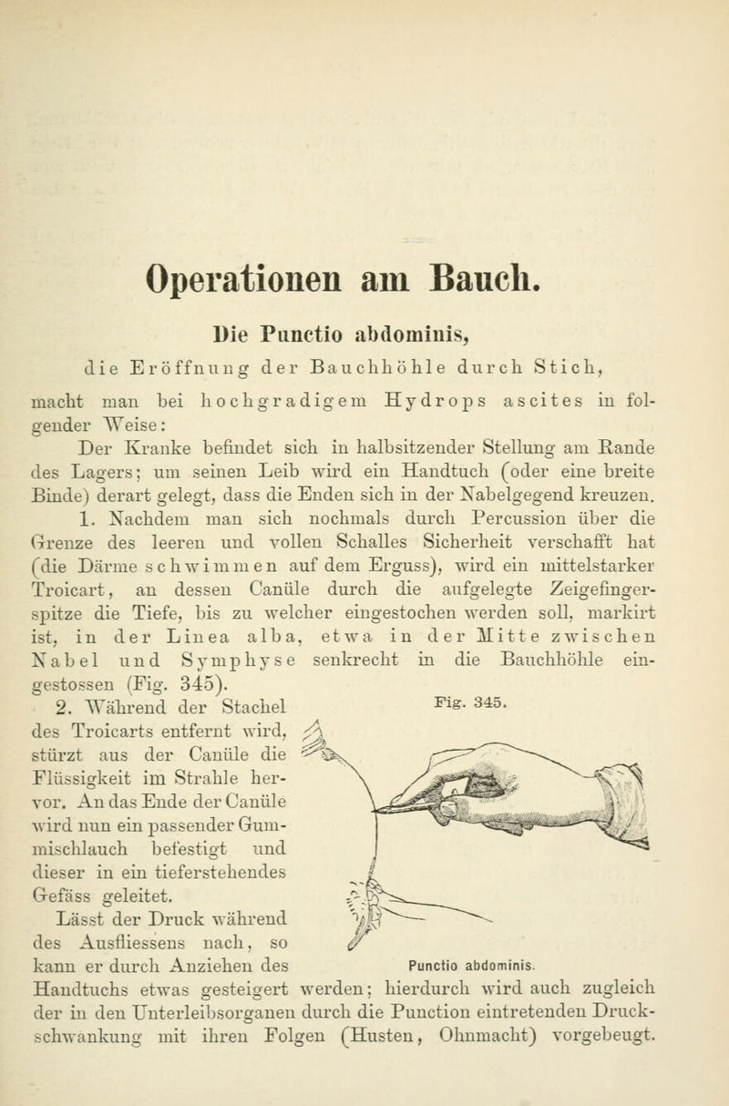 Operationen am Bauch. Die Piinctio abdomiuis, die Eröffnung der Bauchhöhle durch Stich, macht mau bei hochgradigem Hydrops a s ci t e s in fol- gender AVeise: Der Kranke befindet sich in halbsitzender Stellung am Rande des Lagers; um seinen Leib wird ein Handtuch (oder eine breite Binde) derart gelegt, dass die Enden sich in der Nabelgegend kreuzen, 1, Nachdem man sich nochmals durch Percussion über die (Irenze des leeren und vollen Schalles Sicherheit verschafft hat (die Därme schwimmen auf dem Erguss), wird ein mittelstarker Troicart, an dessen Canüle durch die aufgelegte Zeigefinger- S23itze die Tiefe, bis zu welcher eingestochen werden soll, markirt ist, in der Linea alba, etwa in der Mitte zwischen Nabel und Svmphvse senkrecht in die Bauchhöhle ein gestossen (Fig. Fig. 345. S 3^ m p h y s e 345). 2. AVährend der Stachel des Troicarts entfernt wird, stürzt aus der Canüle die Flüssigkeit im Strahle her- vor. An das Ende der Canüle wird nun ein passender Gum- mischlauch befestigt und dieser in ein tieferstehendes Gefäss geleitet. Lässt der Druck während des Ausfliessens nach, so kann er durch Anziehen des Punctio abdominis. Handtuchs etwas ö'esteioert werden: hierdurch wird auch zugleich der in den Unterleibsorganen durch die Function eintretenden Druck- schwankung mit ihren Folgen (Husten, Ohnmacht) vorgebeugt.