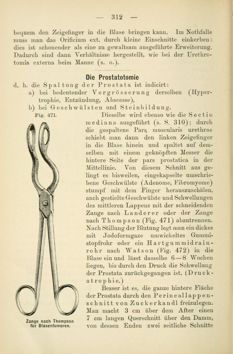 bequem den Zeigefinger in die Blase bringen kann. Im Nothfalle muss man das Orificium ext. durch kleine Einschnitte einkerben: dies ist schonender als eine zu gewaltsam ausgeführte Erweiterung. Dadurch sind dann Verhältnisse hergestellt, wie bei der Urethro- tomia externa beim Manne (s. o.). d. h indicirt: derselben (Hyper- Die Prostatotomie die Spaltung der Prostata ist a) bei bedeutender Vergrösserui trophie, Entzündung, Abscesse), b) bei Geschwülsten und Steinbildung. Fig. 471. Dieselbe wird ebenso wie die Sectio mediana ausgeführt (s. S. 310); durch die gespaltene Pars, muscularis urethrae schiebt man dann den linken Zeigefinger in die Blase hinein und spaltet auf dem- selben mit einem geknöpften Messer die hintere Seite der pars prostatica in der J\[ittellinie. Von diesem Schnitt aus ge- lingt es bisweilen, eingekapselte umschrie- bene Geschwülste (Adenome, Eibromyome) stumpf mit dem Finger herauszuschälen, anch gestielte Geschwülste und Schwellungen des mittleren Lappens mit der schneidenden Zange nach Land er er oder der Zange nach Thompson (Eig. 471) abzutrennen. Nach Stillung der Blutung legt man ein dickes mit Jodoformgaze umwickeltes Gummi- stopfrohr oder ein Hartgummidrain- rohr nach Watson (Eig. 472) in die Blase ein und lässt dasselbe 6 — 8 AYochen liegen, bis durch den Druck die Schwellung der Prostata zurückgegangen ist. (Druck- atrophie.) Besser ist es, die ganze hintere Eläche der Prostata durch den Perineallap pen- schnitt von Zuckerkandl freizulegen. Man macht 3 cm über dem After einen , „. TU 7 cm langen Querschnitt über den Damm, Zange nach Thompson » ^ • • t i o i • für Blasentumoren. von dessen Enden zwei seitliche Schnitte