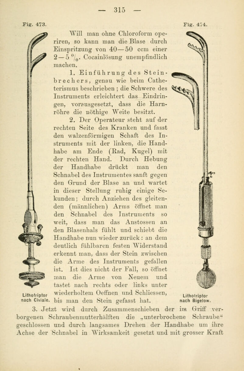 Fig. 473. Fig. 474. Will man ohne Chloroform ope- riren, so kann man die Blase durch Einspritzung von 40—50 ccm einer 2 — 5 ^/q. Cocainlösung unempfindlich machen. 1. Einführung des Stein- brechers, genau wie beim Cathe- terismus beschrieben ; die Schwere des Instruments erleichtert das Eindrin- gen, vorausgesetzt, dass die Harn- röhre die nöthige Weite besitzt. 2. Der Operateur steht auf der rechten Seite des Kranken und fasst den walzenförmigen Schaft des In- struments mit der linken, die Hand- habe am Ende (ßad, Kugel) mit der rechten Hand. Durch Hebung der Handhabe drückt man den Schnabel des Instrumentes sanft gegen den Grund der Blase an und wartet in dieser Stellung ruhig einige Se- kunden ; durch Anziehen des gleiten- den (männlichen) Arms öffnet man den Schnabel des Instruments so weit, dass man das Anstossen an den Blasenhals fühlt und schiebt die Handhabe nun wieder zurück : an dem deutlich fühlbaren festen Widerstand erkennt man, dass der Stein zwischen die Arme des Instruments gefallen ist. Ist dies nicht der Fall, so öffnet man die Arme von Neuem und tastet nach rechts oder links unter Lithoiriptor wiederholtem Oeffnen und Schliessen, nach Civiale. bis man den Stein gefasst hat. 3. Jetzt wird durch Zusammenschieben der im Griff ver- borgenen Schraubenmutterhälften die „unterbrochene Schraube'* geschlossen und durch langsames Drehen der Handhabe um ihre Achse der Schnabel in Wirksamkeit gesetzt und mit grosser Kraft Lithoiriptor nach Bigeiow.