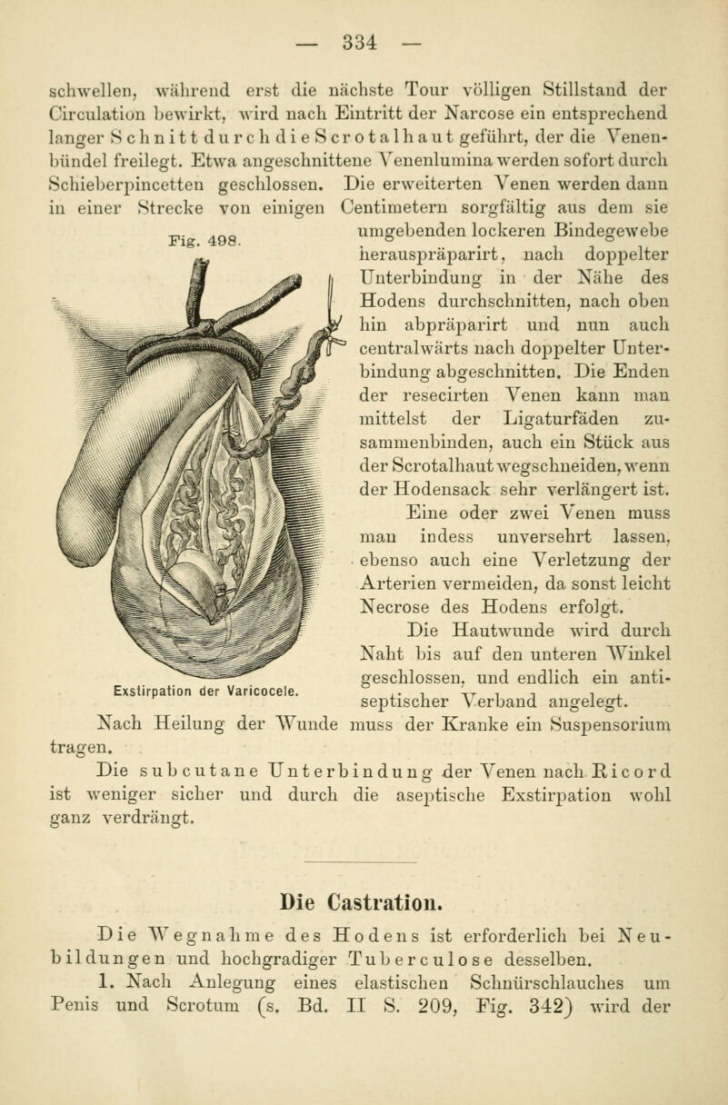 schwellen, während erst die nächste Tour völligen Stillstand der Circulation bewirkt, wird nach Eintritt der Narcose ein entsprechend langer Schnitt durch dieScrotalhaut geführt, der die Venen- bündel freileert. Etwa ang-eschnitteue Yenenluraina werden sofort durch Schieberpincetten geschlossen, in einer Strecke von einigen Fig. 498. Die erweiterten Venen werden dann Centiraetern sorgfältig aus dem sie umgebenden lockeren Bindegewebe herauspräparirt, nach doppelter Unterbindung in der Nähe des Hodens durchschnitten, nach oben hin abpräparirt und nun auch centralwärts nach doppelter Unter- bindung abgeschnitten. Die Enden der resecirten Venen kann man mittelst der Ligaturfäden zu- sammenbinden, auch ein Stück aus der Scrotalhaut wegschneiden, wenn der Hodensack sehr verlängert ist. Eine oder zwei Venen muss man indess unversehrt lassen, ebenso auch eine Verletzung der Arterien vermeiden, da sonst leicht Necrose des Hodens erfolgt. Die Hautwunde wird durch Naht bis auf den unteren Winkel geschlossen, und endlich ein anti- septischer Verband angelegt. Nach Heilung der Wunde muss der Kranke ein Suspensorium tragen. Die subcutane Unterbindung der Venen nach E, i c o r d ist weniger sicher und durch die aseptische ExstirjDation wohl ganz verdrängt. Exstirpation der Varicocele. Die Castratiou. Die Wegnahme des Hodens ist erforderlich bei Neu- bildungen und hochgradiger Tuberculose desselben. 1. Nach Anlegung eines elastischen Schnürschlauches um Penis und Scrotum (s. Bd. II S. 209, Fig. 342) wird der