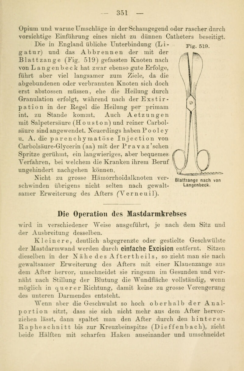 Opium und wanne Umschläge in der Schamgegend oder rascher durch vorsichtige Einführung eines nicht zu dünnen Catheters beseitigt. Die in England übliche Unterbindung (Li- gatur) und das Abbrennen der mit der Blattzange (Fig. 519) gefassten Knoten nach von Langenbeck hat zwar ebenso gute Erfolge, führt aber viel langsamer zum Ziele, da die abgebundenen oder verbrannten Knoten sich doch erst abstossen müssen, ehe die Heilung durch Granulation erfolgt, während nach der Exstir- pation in der Regel die Heilung per primam int. zu Stande kommt. Auch Aetzungen mit Salpetersäure (H o u s t o n) und reiner Carbol- säure sind angewendet. Neuerdings haben P o o 1 e y u. A. die parenchymatöse Injection von Carbolsärure-Glycerin (aa) mit der Pravaz'sehen Spritze gerühmt, ein langwieriges, aber bequemes Verfahren, bei welchem die Kranken ihrem Beruf \\ ungehindert nachgehen können. Nicht zu grosse Hämorrhoidalknoten ver- schwinden übrigens nicht selten nach gewalt- samer Erweiterung des Afters (Verneuil). Fig. 519. Blattzange nach von Langenbeck. Die Operation des Mastdarmkrebses wird in verschiedener Weise ausgeführt, je nach dem Sitz und der Ausbreitung desselben. Kleinere, deutlich abgegrenzte oder gestielte Geschwülste der Mastdarmwand werden durch einfache ExcisiOIl entfernt. Sitzen dieselben in der Nähe des Aftertheils, so zieht man sie nach gewaltsamer Erweiterung des Afters mit einer Klauenzange aus dem After hervor, umschneidet sie ringsum im Gesunden und ver- näht nach Stillung der Blutung die Wundfläche vollständig, wenn möglich in querer Bichtung, damit keine zu grosse Verengerung des unteren Darmendes entsteht. Wenn aber die Geschwulst so hoch oberhalb der Anal- portion sitzt, dass sie sich nicht mehr aus dem After hervor- ziehen lässt, dann spaltet man den After durch den hinteren Bapheschnitt bis zur Kreuzbeinspitze (D ief f enb ach), zieht beide Hälften mit scharfen Haken auseinander und umschneidet