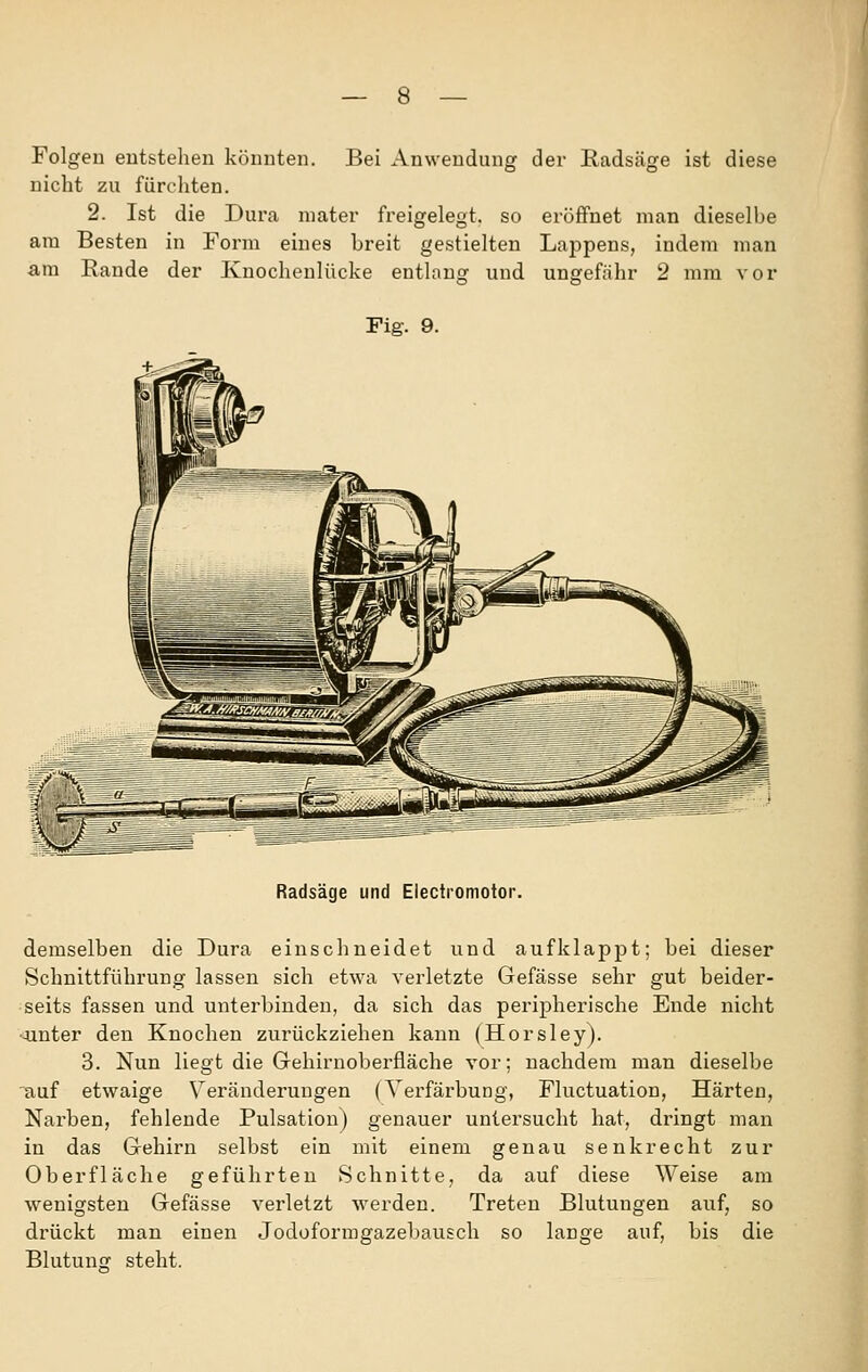 Folgen entstehen könnten. Bei Anwendung der Radsäge ist diese nicht zu fürchten. 2. Ist die Dura niater freigelegt, so eröflfnet man diesell)e am Besten in Form eines breit gestielten Lappens, indem man am Rande der Knochenlücke entlaug und ungefähr 2 mm vor Fig. 9. Radsäge und Electromotor. demselben die Dura einschneidet und aufklappt; bei dieser Schnittführung lassen sich etwa verletzte Gefässe sehr gut beider- seits fassen und unterbinden, da sich das peripherische Ende nicht -unter den Knochen zurückziehen kann (Horsley). 3. Nun liegt die Grehirnobei'fläche vor; nachdem man dieselbe auf etwaige Veränderungen (Verfärbung, Fluctuation, Härten, Narben, fehlende Pulsation) genauer unlei'sucht hat, dringt man in das Gehirn selbst ein mit einem genau senkrecht zur Oberfläche geführten Schnitte, da auf diese Weise am wenigsten Gefässe verletzt werden. Treten Blutungen auf, so drückt man einen Jodoformgazebausch so lange auf, bis die BlutuniT steht.