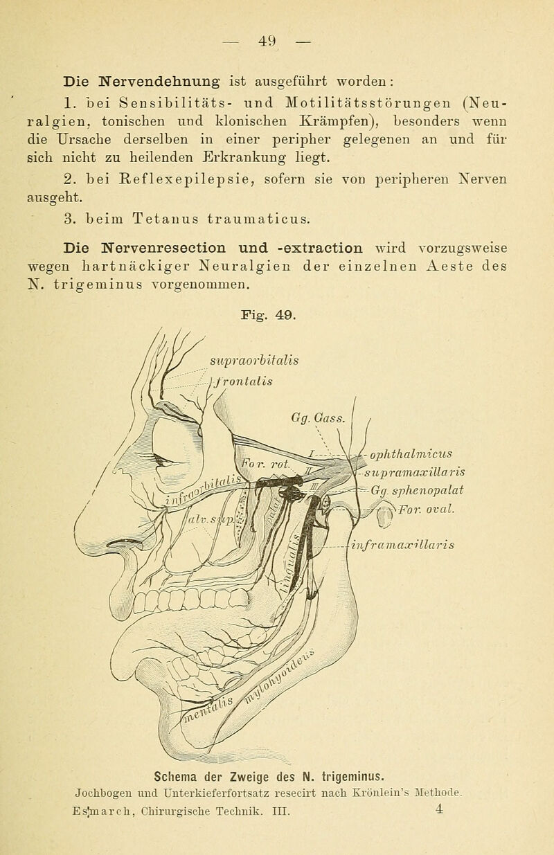 Die Nervendehnung ist ausgeführt worden: 1. bei Sensibilitäts- und Motilitätsstörungen (Neu- ralgien, tonischen und klonischen Krämpfen), besonders wenn die Ursache derselben in einer peripher gelegenen an und für sich nicht zu heilenden Erkrankung liegt. 2. bei Reflexepilepsie, sofern sie von peripheren Nerven ausgeht. 3. beim Tetanus traumaticus. Die Nervenreseetion und -extraetion wird vorzugsweise wegen hartnäckiger Neuralgien der einzelnen Aeste des N. trigeminus vorgenommen. Fig. 49. - ophthalniicus s upramaxiüaris Gg sphenopalat ^■For. oval. 2 iifra maxi' llaris Schema der Zweige des N. trigeminus. Jocliliogen und Unterkieferfortsatz resecirt nach Krönlein's Jletliode. Eslmarch, Chirurgische Technik. III. *