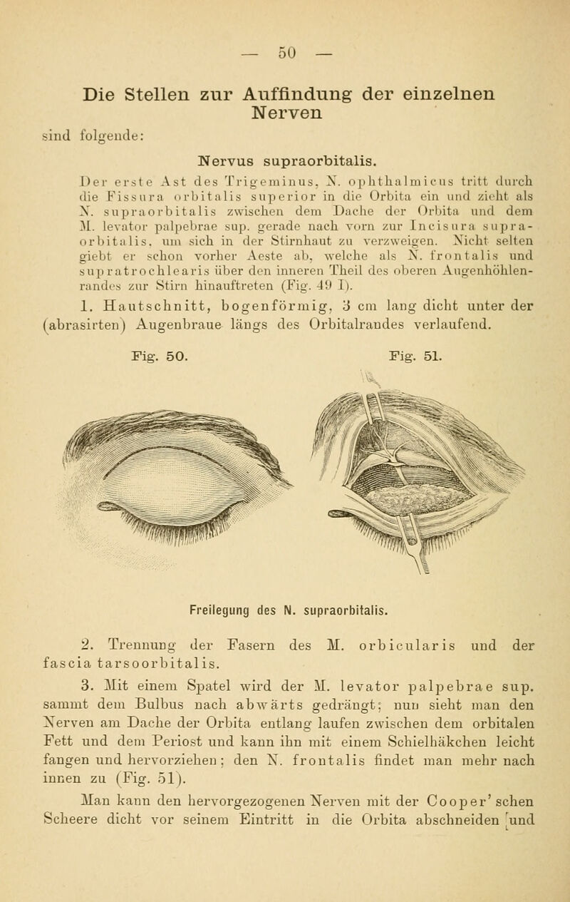 Die Stellen zur Auffindung der einzelnen Nerven sind folgende: Nervus supraorbitalis. Der erste Ast des Trigenünus. ^. o])litha Im i e us tritt tlnrch die Fissura orbitalis superior in die Orbita ein und zieht als X. supraorbitalis zwischen dem Dache der Orbita und dem ]\l. levator palpebrae sup. gerade nach vorn zur Incisura supra- orbitalis. um sich in der Stirnhaut zu verzweigen. Nicht selten giebt er schon vorher Aeste ab, w'elche als N. frontalis und supratrochlearis über den inneren Theil des oberen Aiigenhöhlen- randes zur Stirn hinauftreten (Fig. Jl» 1). 1. Hautschnitt, bogenförmig, 3 cm lang dicht unter der (abrasirten) Augenbraue längs des Orbitalrandes verlaufend. Fig. 50. Fig. 51. Freiiegung des N. supraorbitalis. 2. Trennung der Fasern des M. orbicularis und der fascia tarsoorbitalis. 3. Mit einem Spatel wird der M. levator paljiebrae sup. sammt dem Bulbus nach abwärts gedrängt; nun sieht man den Nerven am Dache der Orbita entlang laufen zwischen dem orbitalen Fett und dem Periost und kann ihn mit einem Schielhäkchen leicht fangen und hervorziehen ; den N. frontalis findet man mehr nach innen zu (Fig. 51). Man kann den hervorgezogenen Nerven mit der Cooper'sehen Scheere dicht vor seinem Eintritt in die Orbita abschneiden 'und