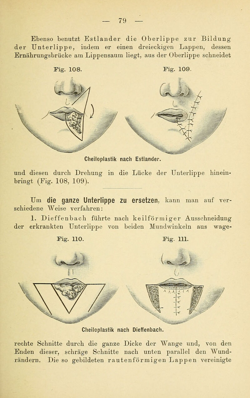 Ebenso benutzt Estlander die Oberlippe zur Bildung der Unterlippe, indem er einen dreieckigen Lappen, dessen Ernäbrungsbrücke am Lippensaum liegt, aus der Oberlippe schneidet Fig. 108. Fig. 109. rj Cheiloplastik nach Estlander. und diesen durch Drehung in die Lücke der Unterlippe hinein- bringt (Fig. 108, 109). Um die ganze Unterlippe zu ersetzen, kann man auf ver- schiedene Weise verfahren: 1. Dieffenbach führte nach keilförmiger Ausschneidung der erkrankten Unterlippe von beiden Mundwinkeln aus wage- Fig. 110. Fig. m. Cheiloplastik nach Dieffenbach. rechte Schnitte durch die ganze Dicke der Wange und, von den Enden dieser, schräge Schnitte nach unten parallel den Wund- rändern. Die so gebildeten rautenförmigen Lappen vereinigte